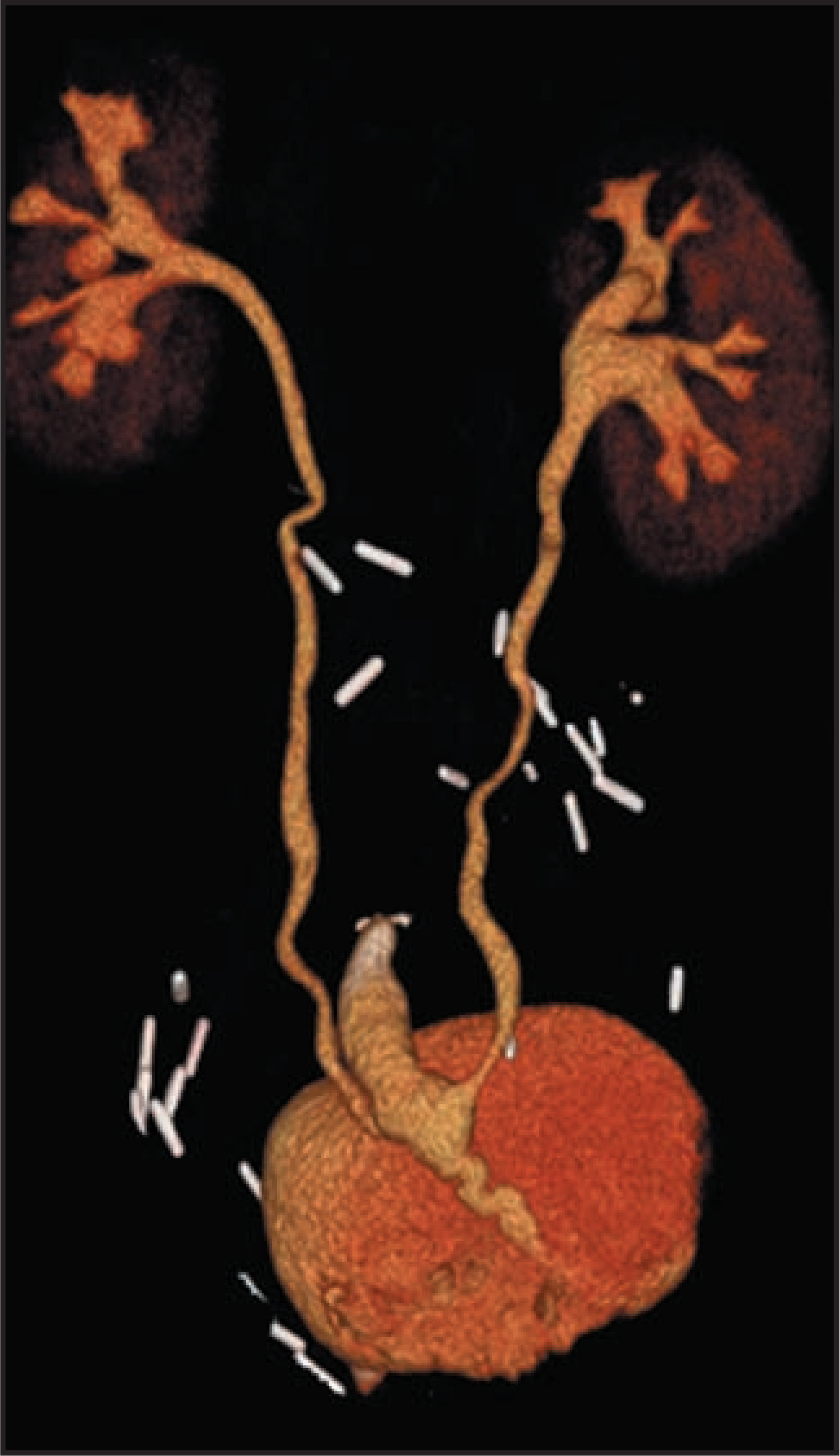 FIGURE 13.
