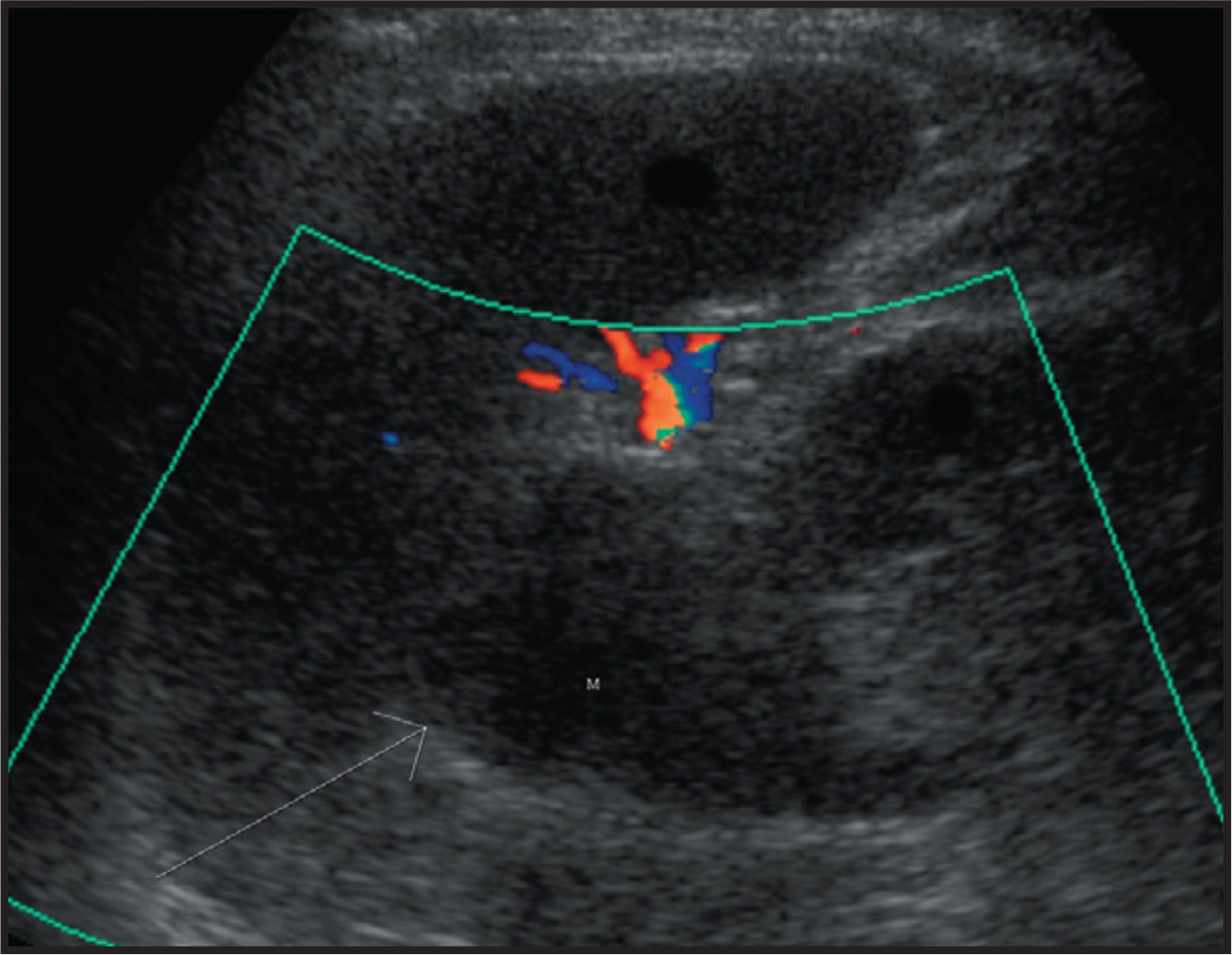 FIGURE 1.