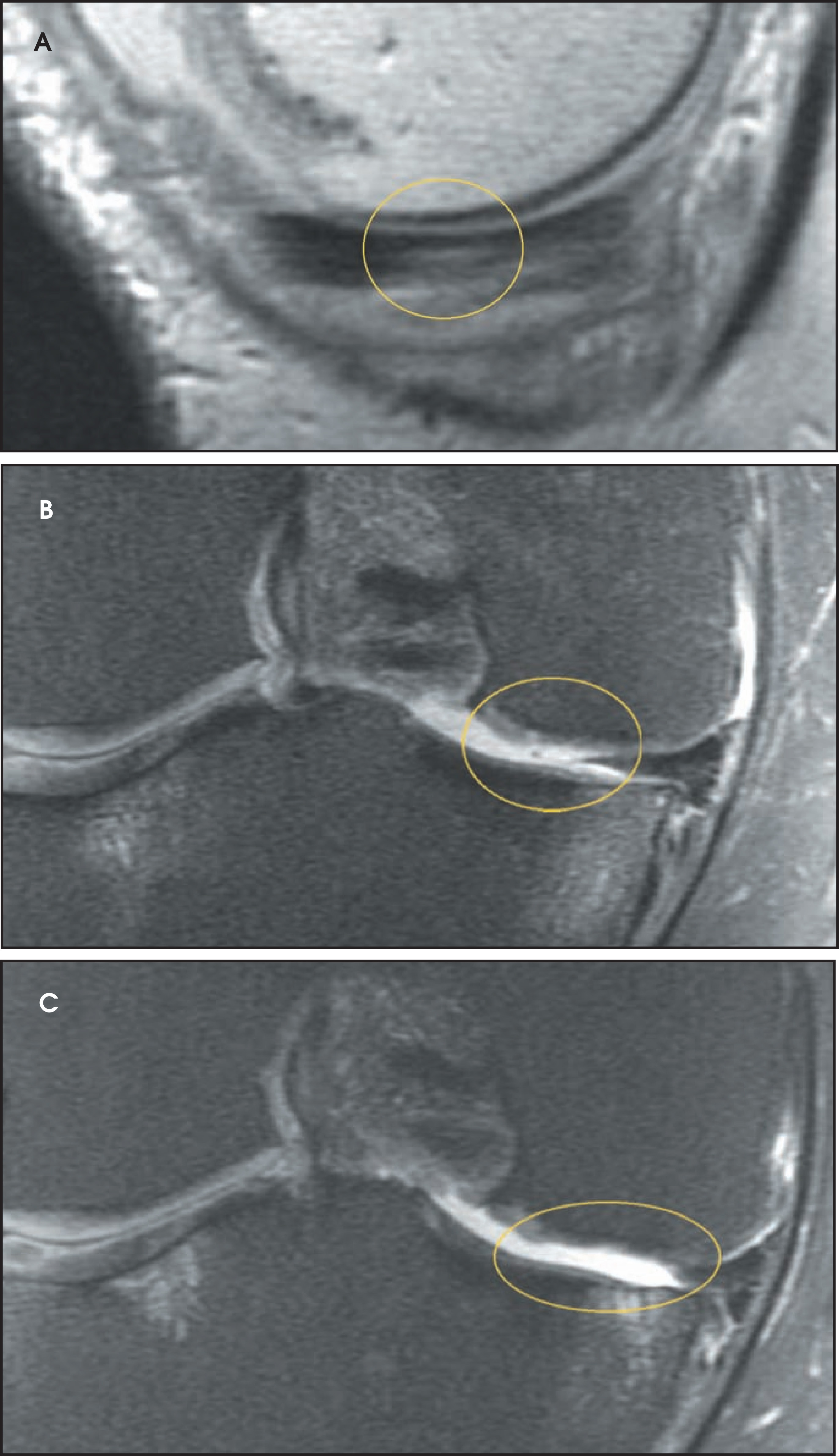 FIGURE 11.