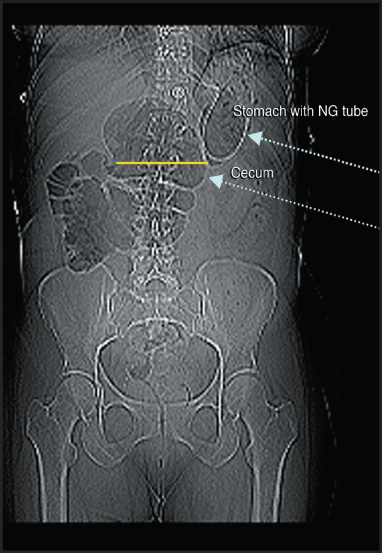 FIGURE 3.