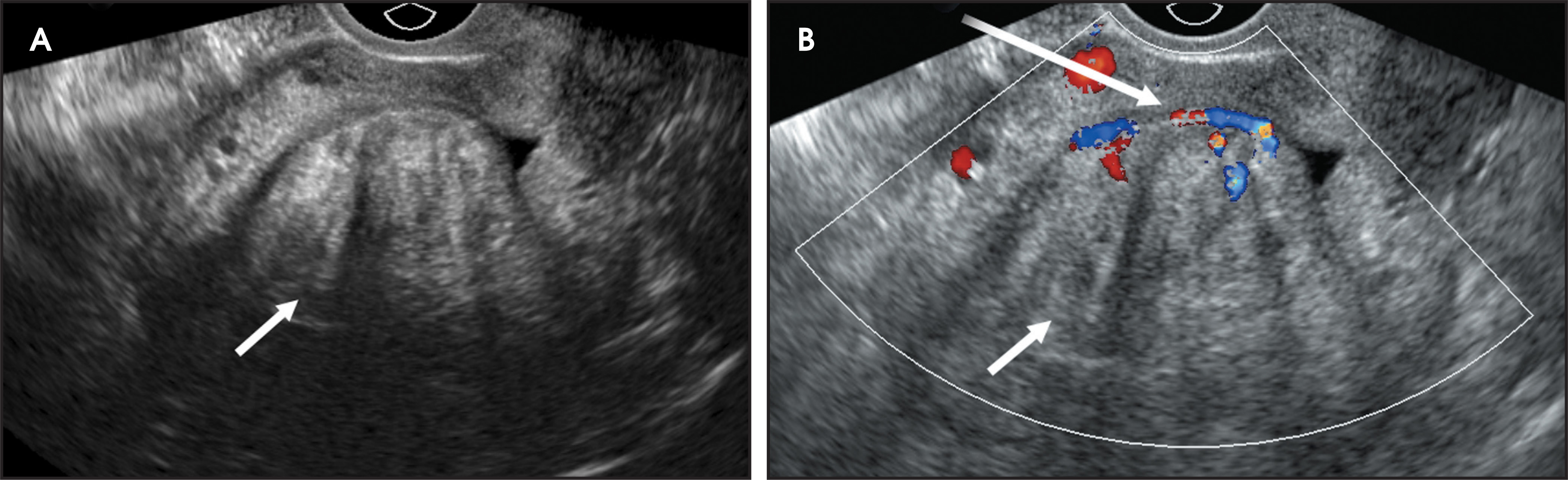 FIGURE 4.