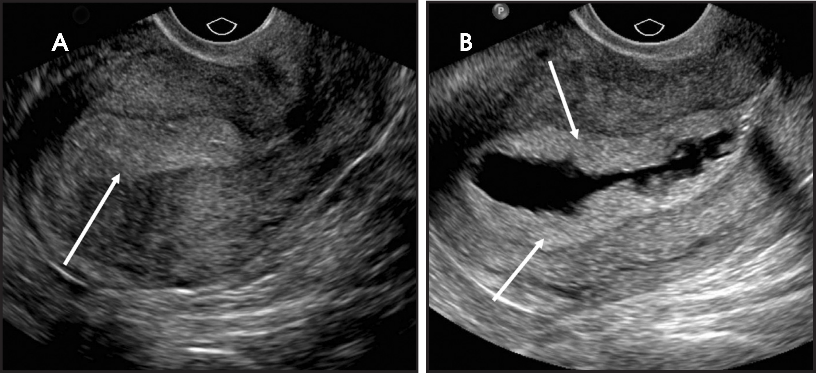 FIGURE 11.