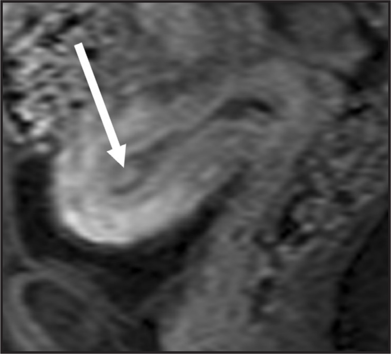 FIGURE 14.