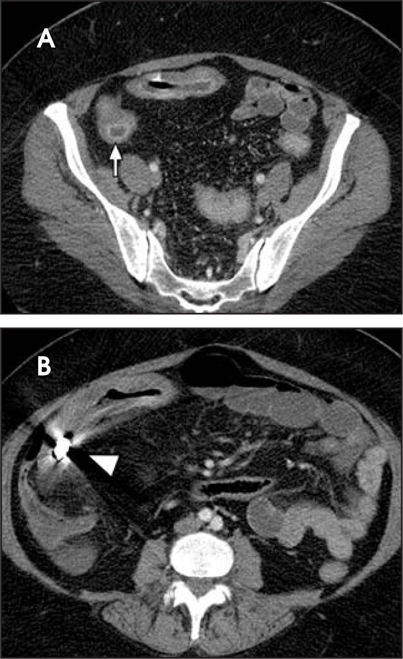 FIGURE 4.