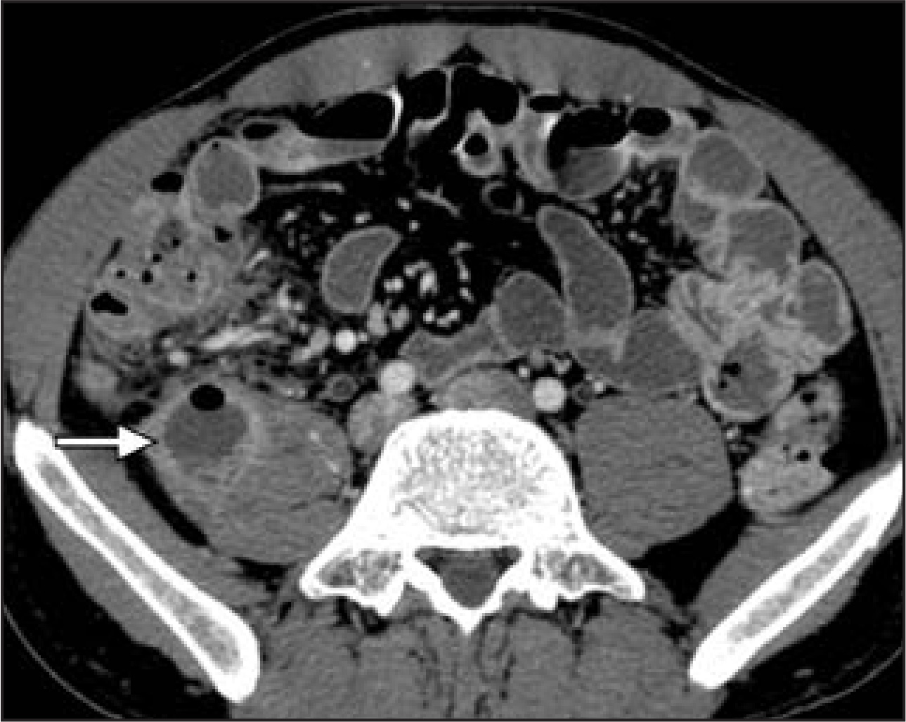 FIGURE 10.