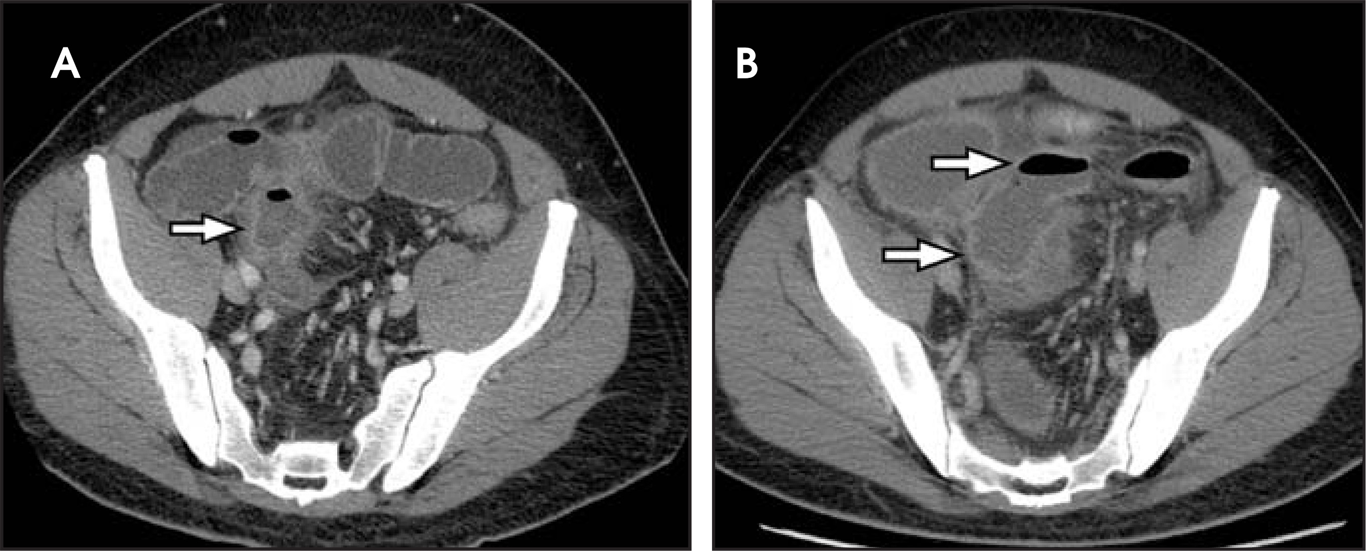 FIGURE 11.