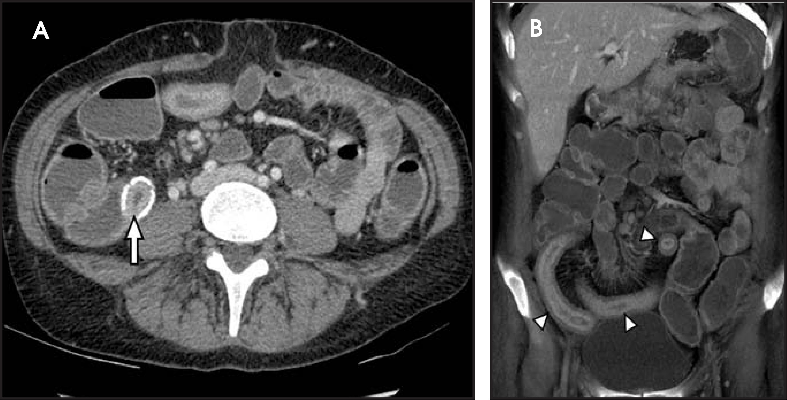 FIGURE 13.
