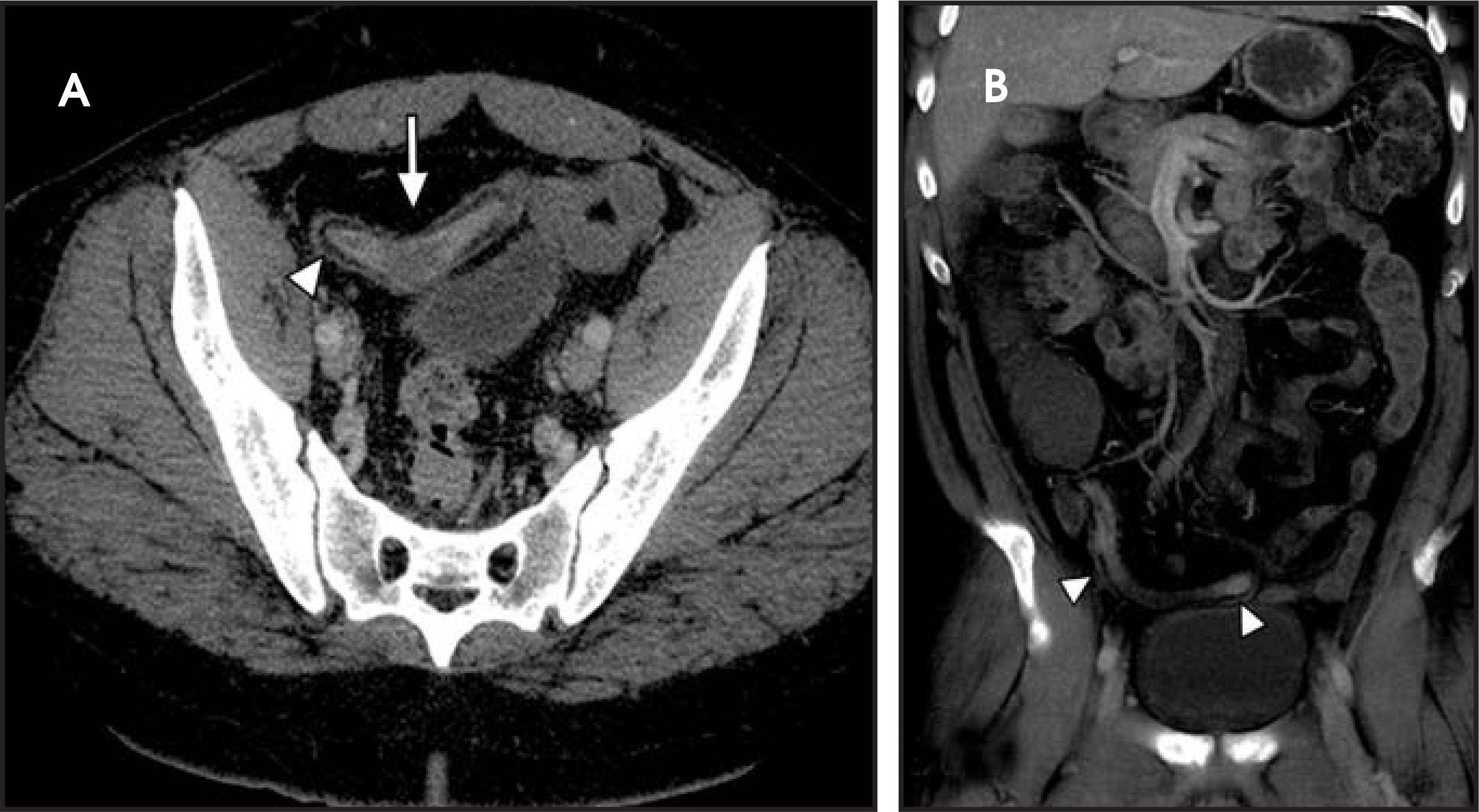 FIGURE 14.