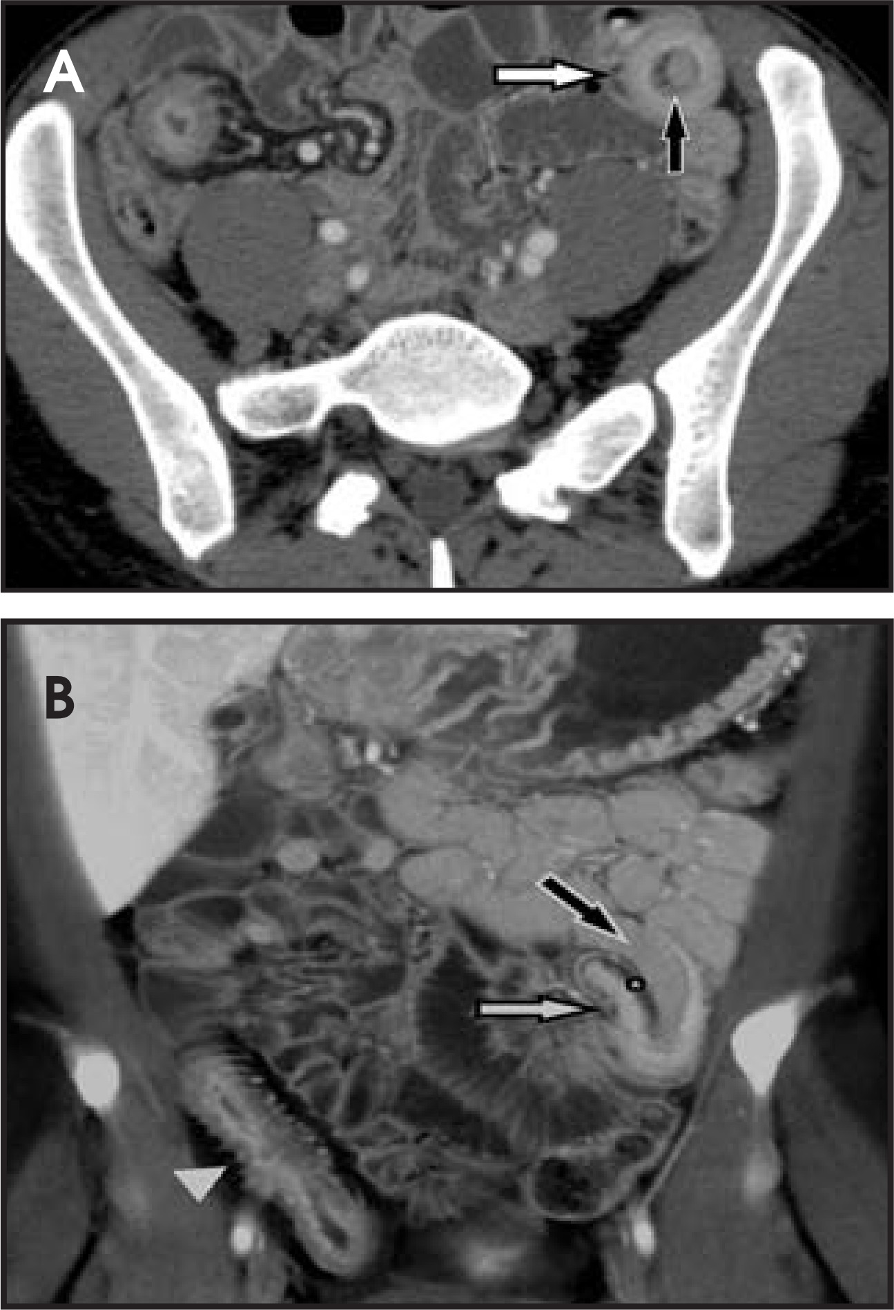 FIGURE 17.