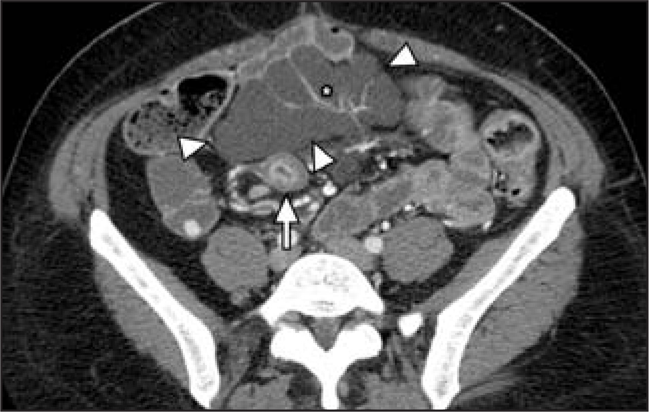 FIGURE 18.