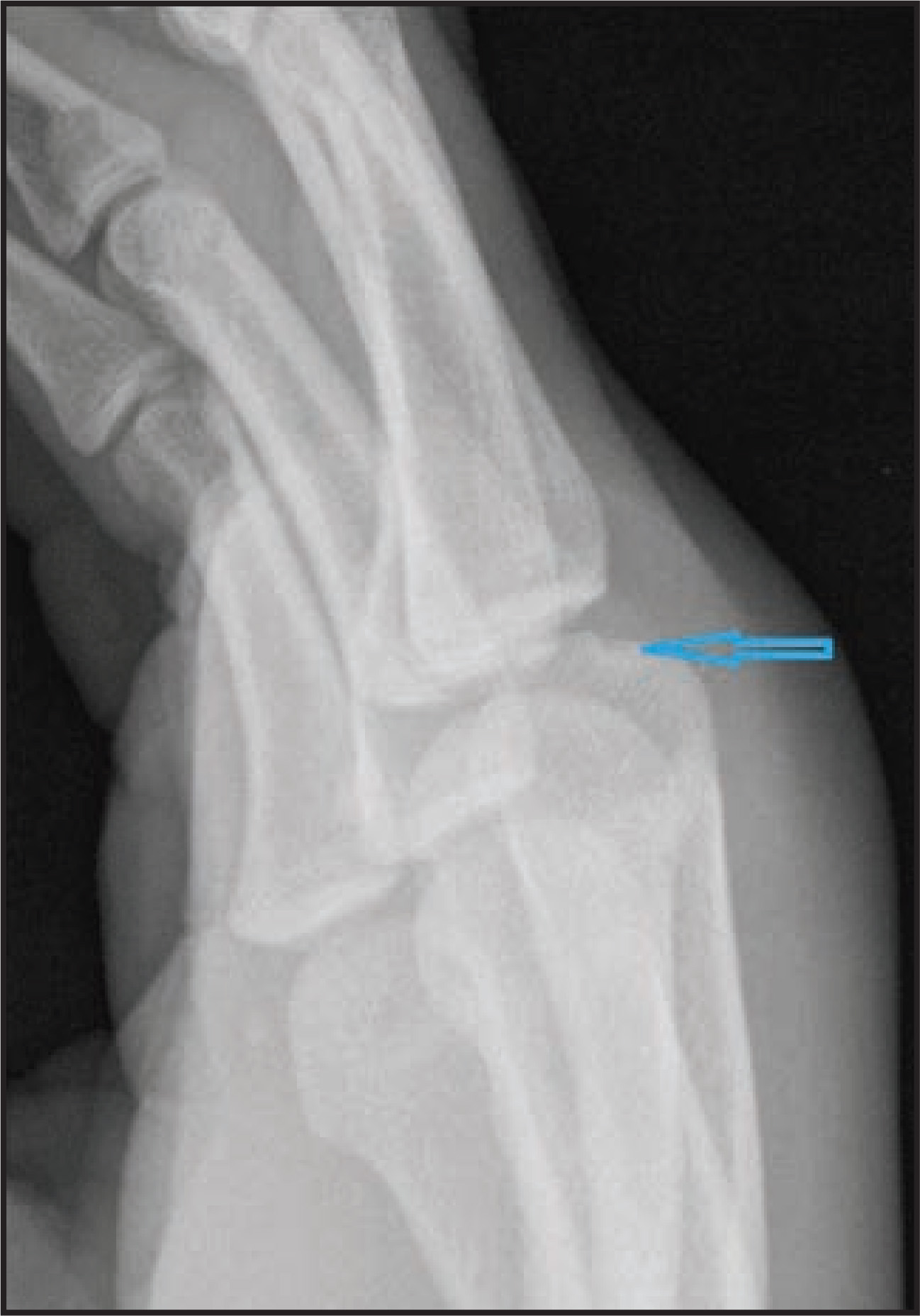 FIGURE 5.