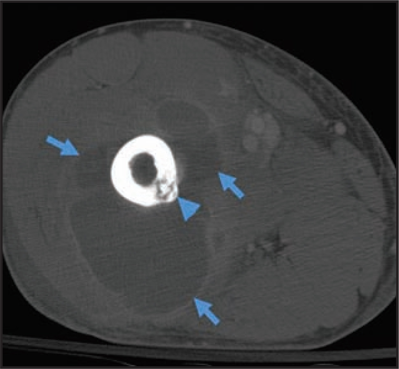 FIGURE 9.