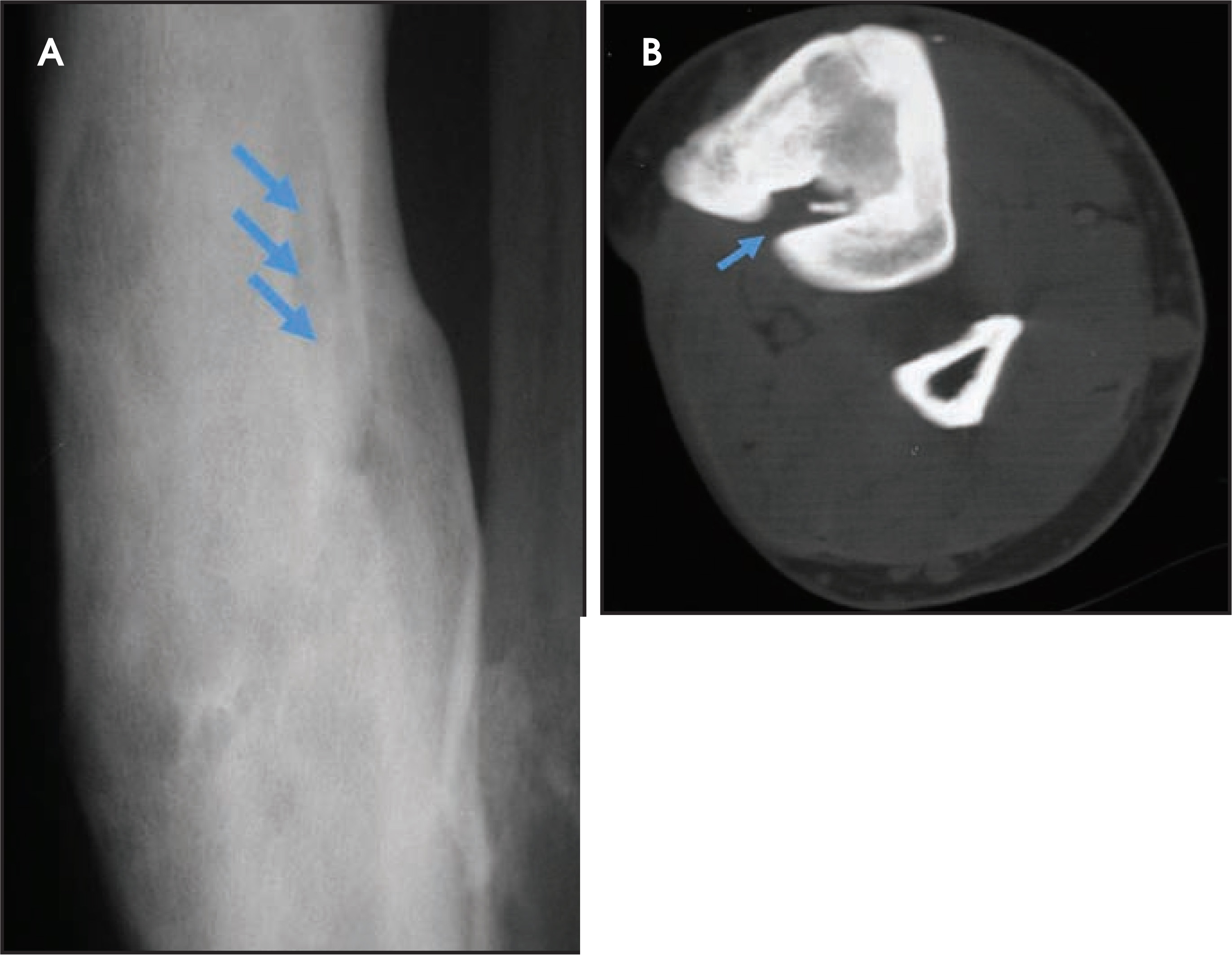 FIGURE 11.
