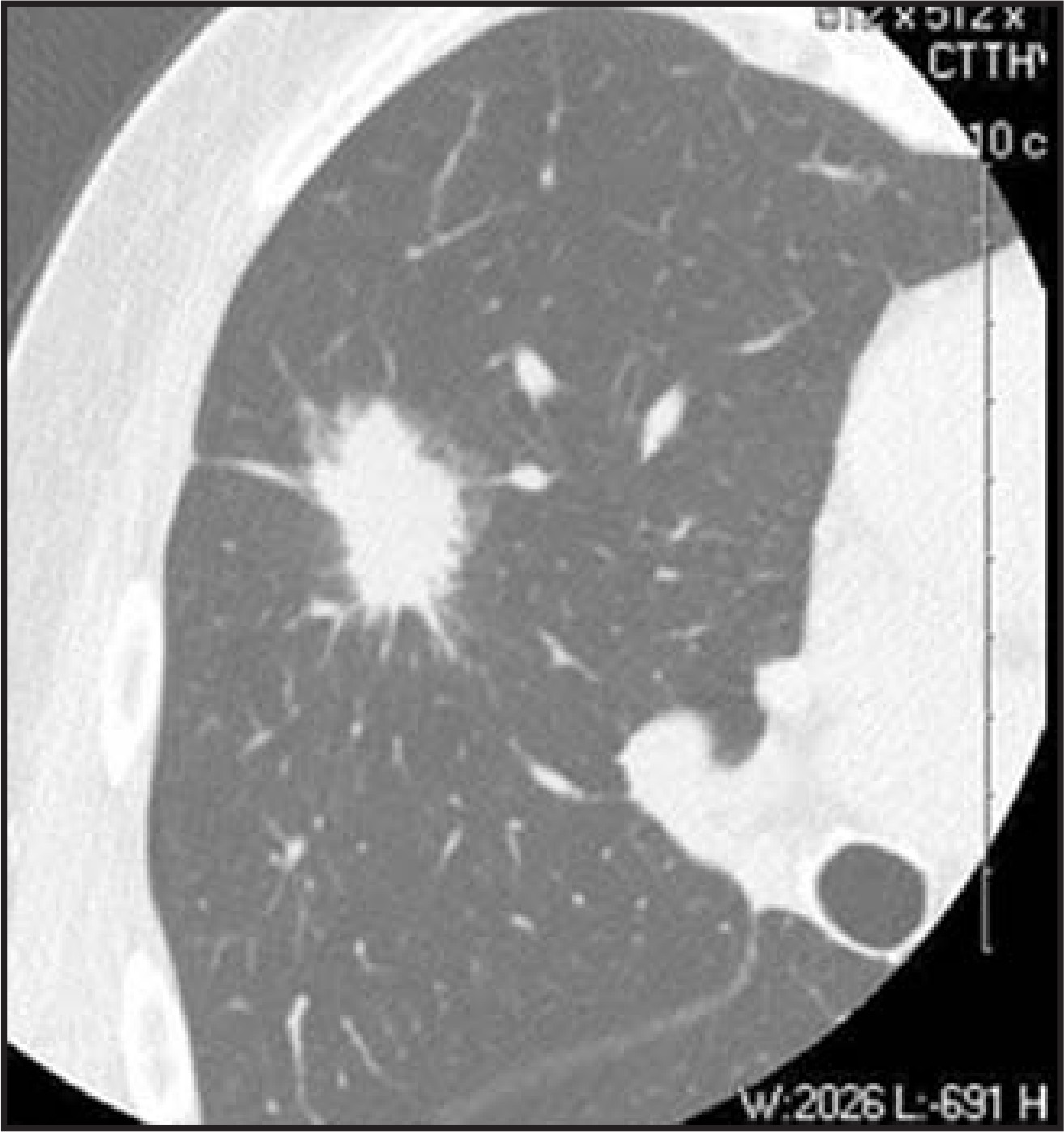FIGURE 11.