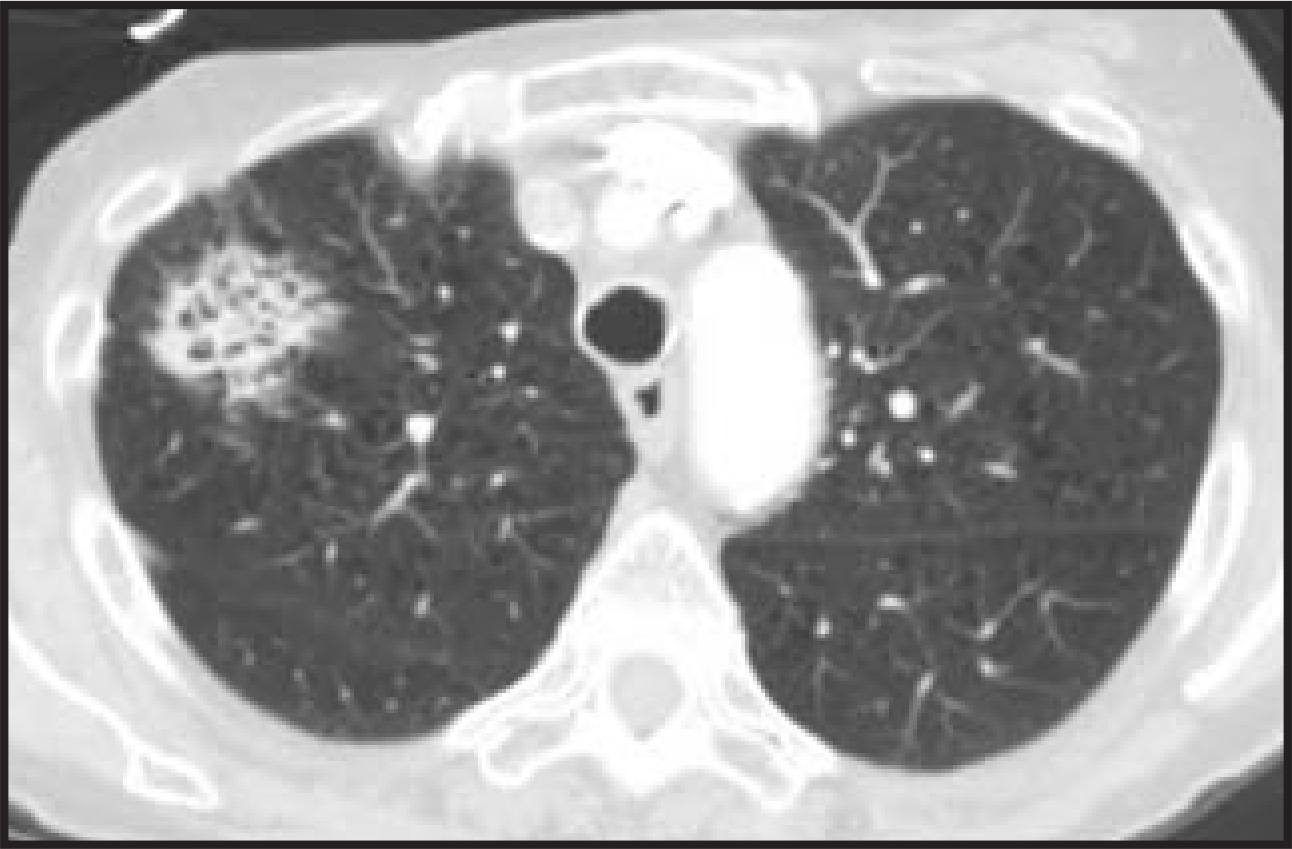 FIGURE 13.