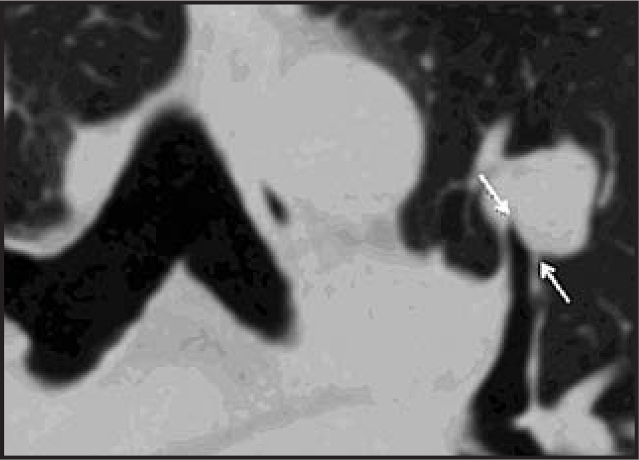 FIGURE 14.