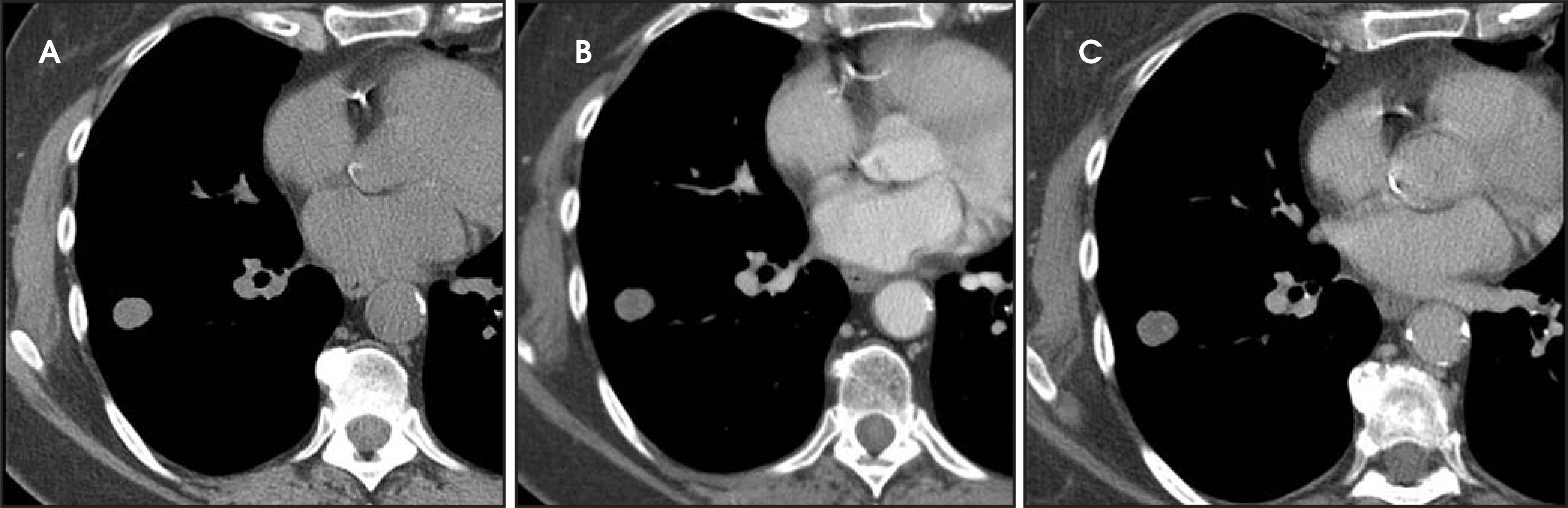 FIGURE 16.