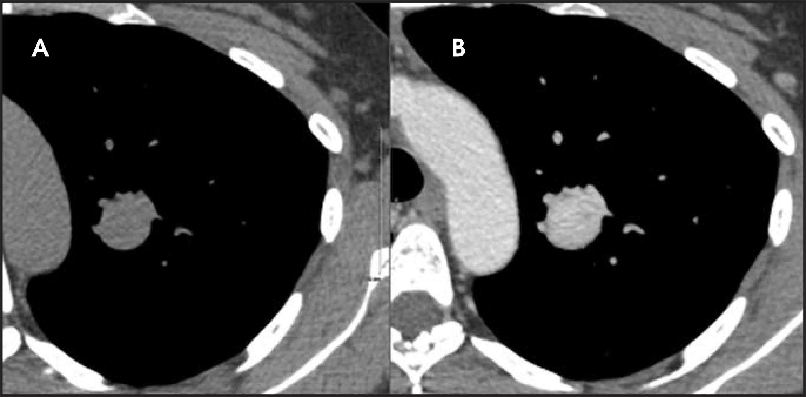 FIGURE 17.