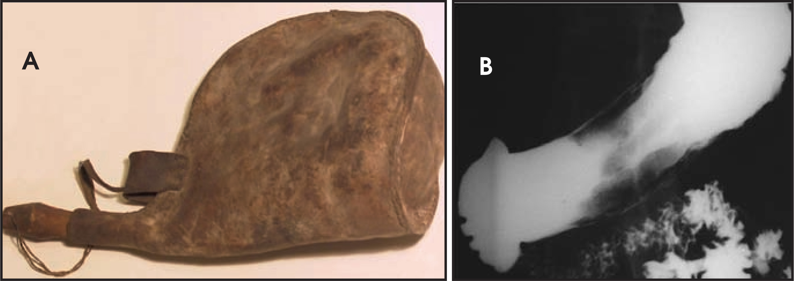 FIGURE 6.