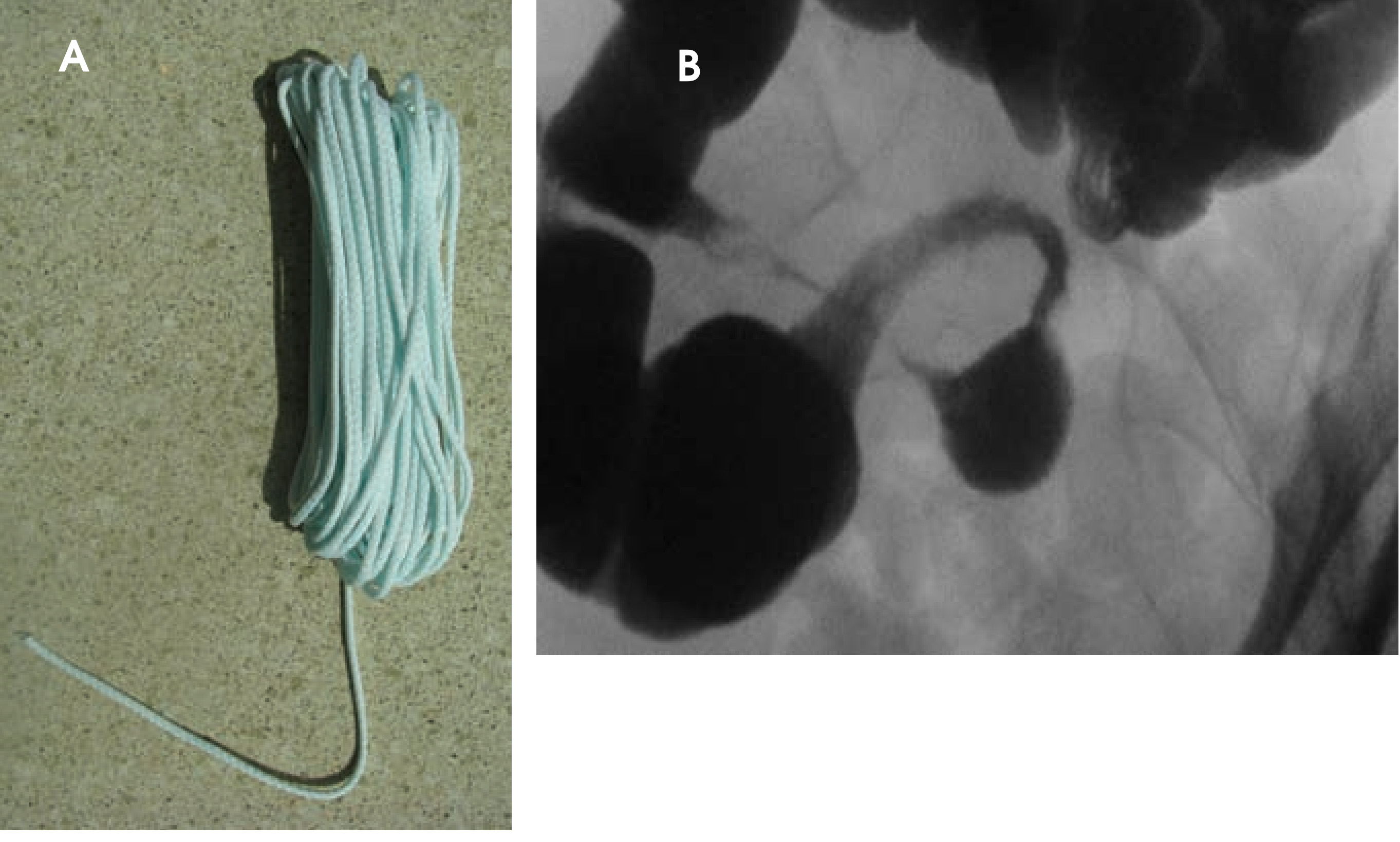 FIGURE 12.