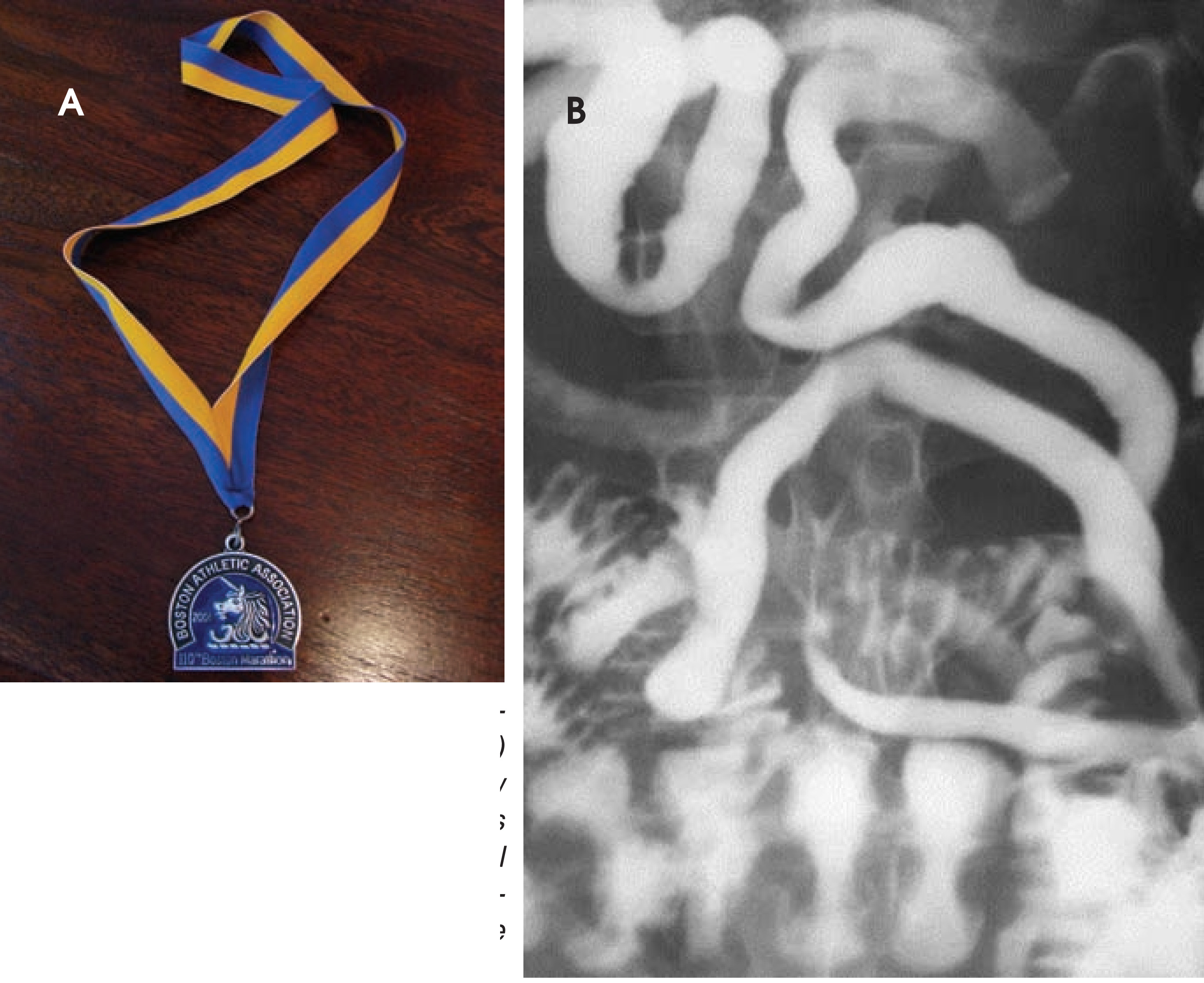 FIGURE 13.