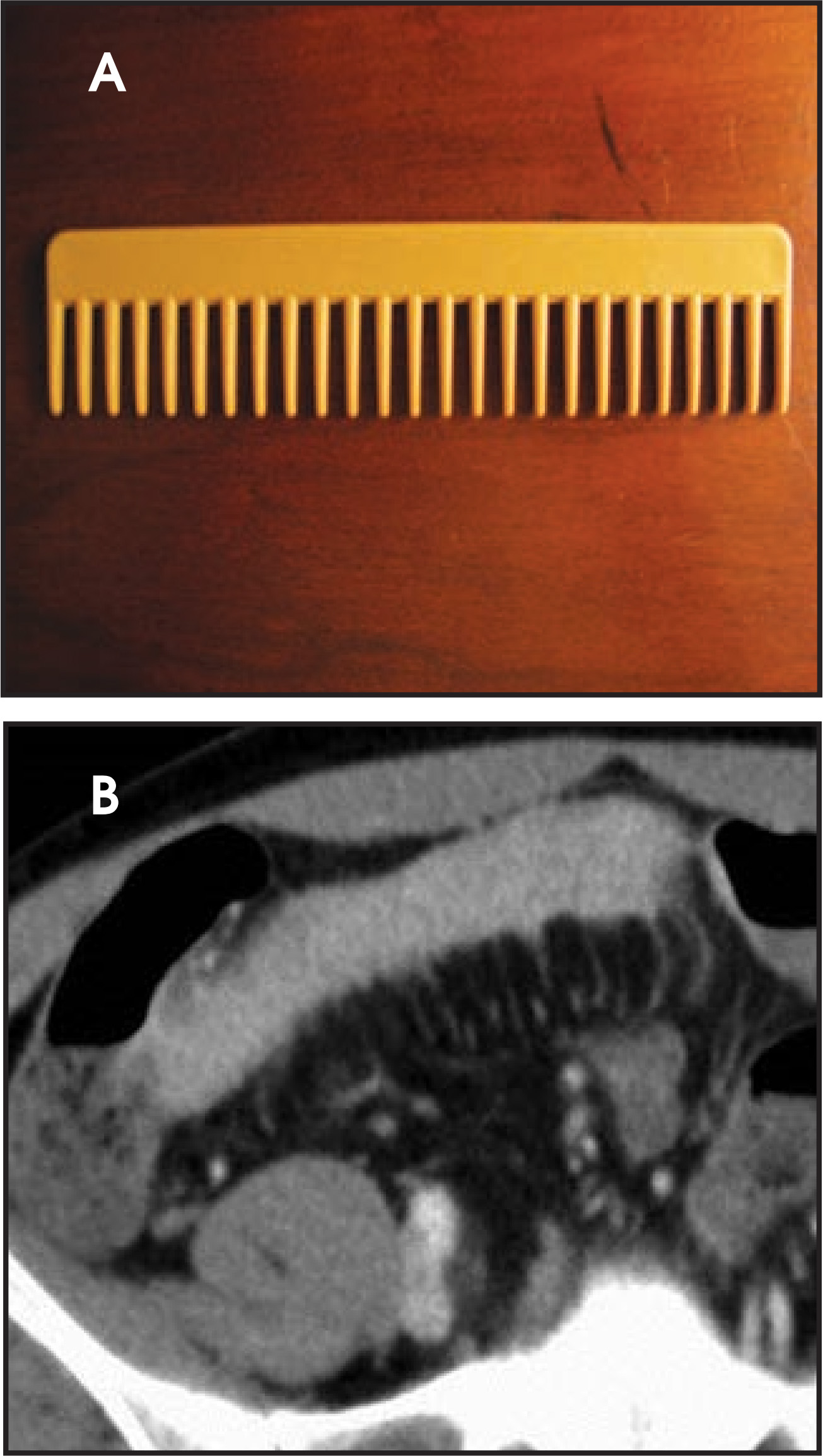FIGURE 14.