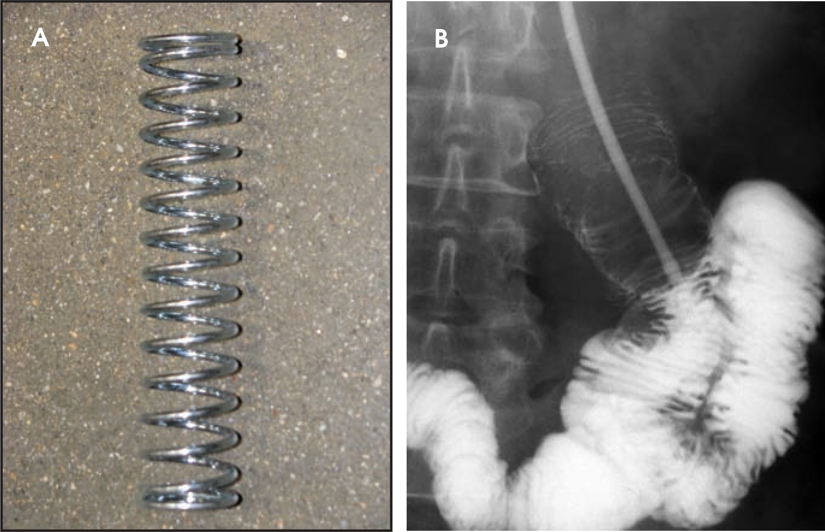 FIGURE 16.