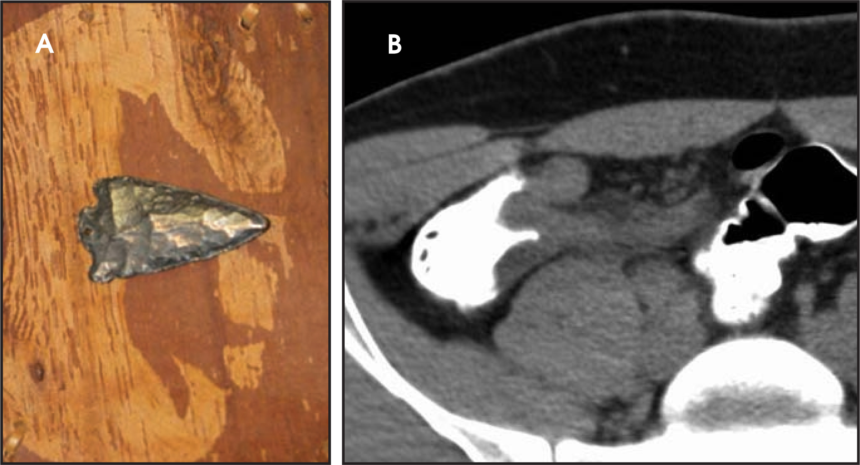 FIGURE 17.