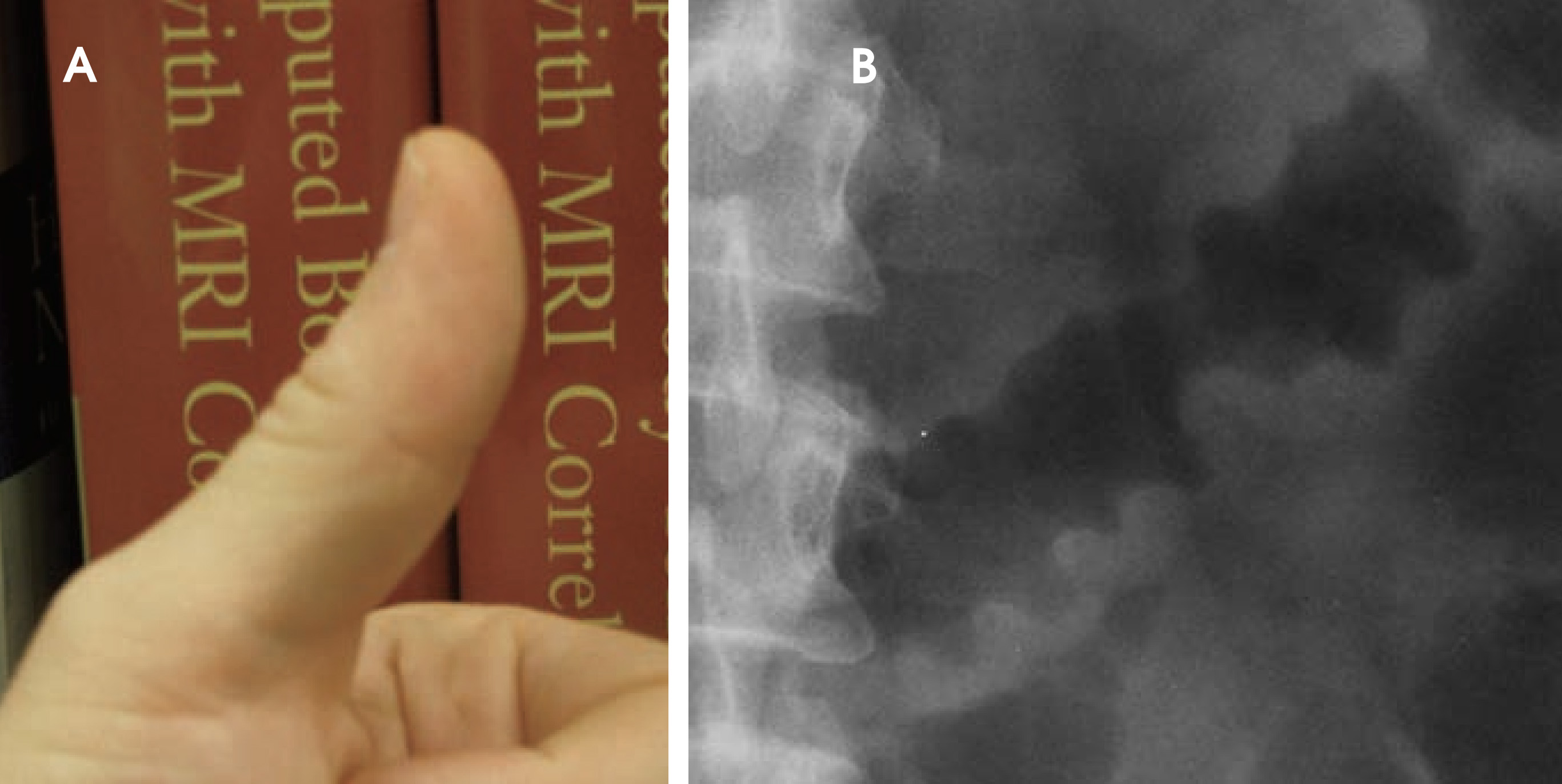 FIGURE 18.