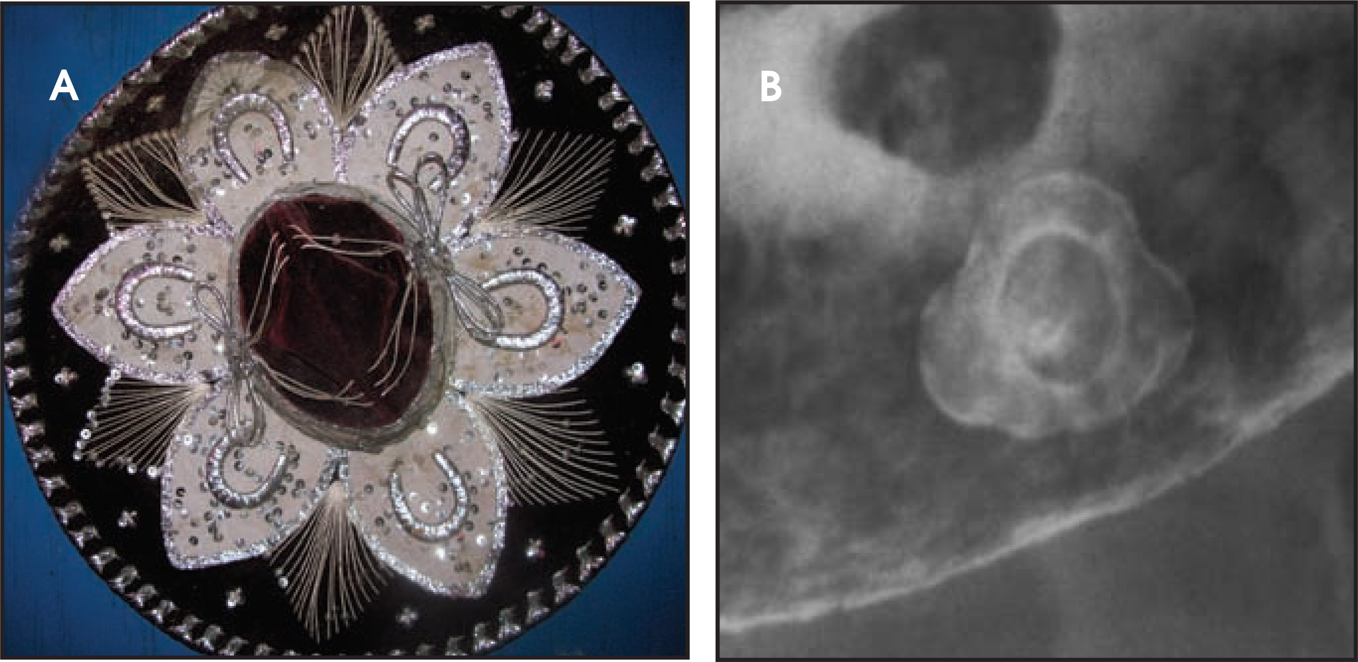 FIGURE 21.
