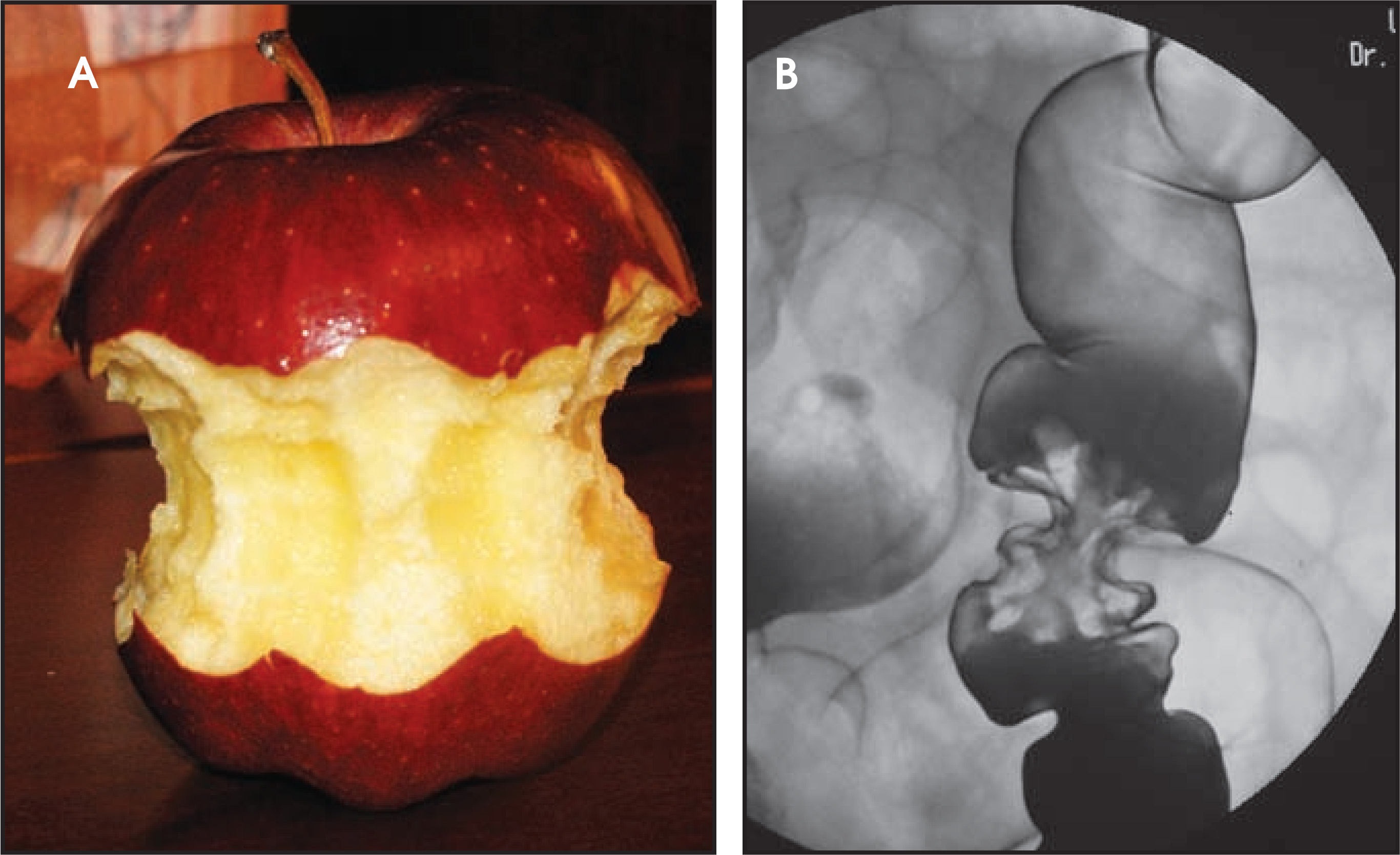 FIGURE 23.