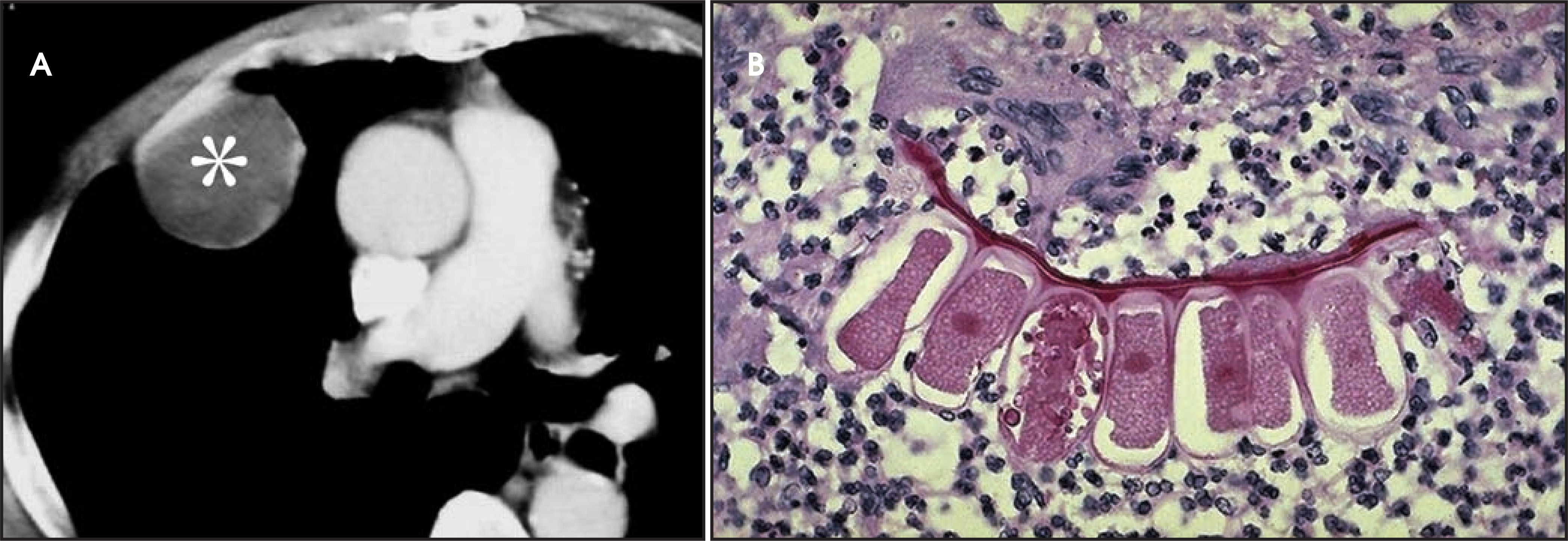 FIGURE 11.
