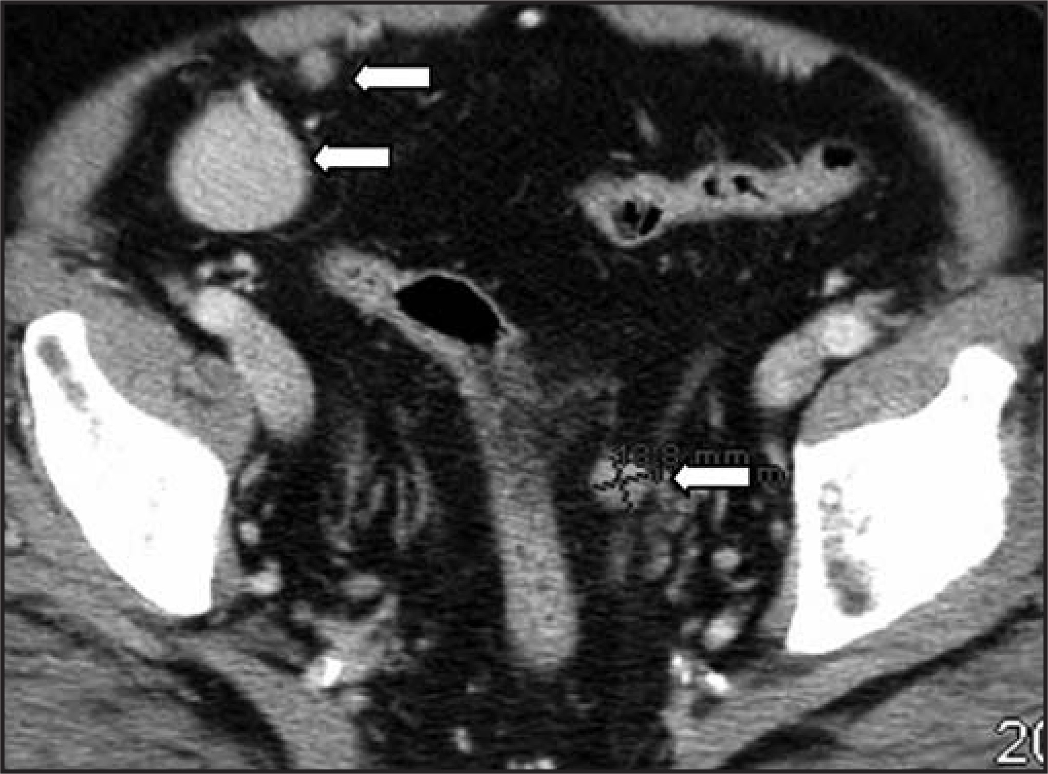 FIGURE 13.