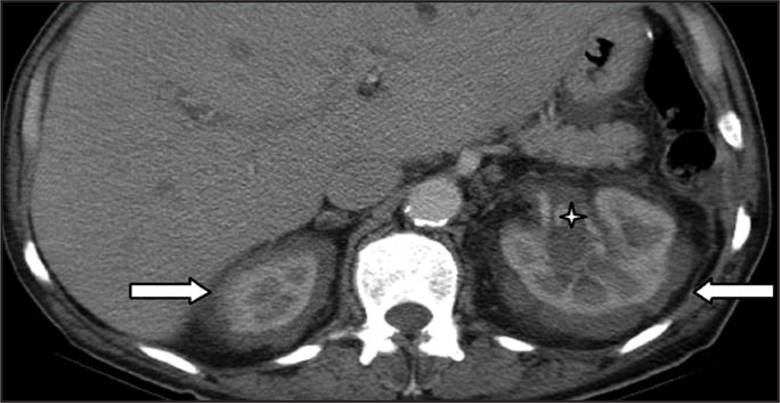 FIGURE 14.