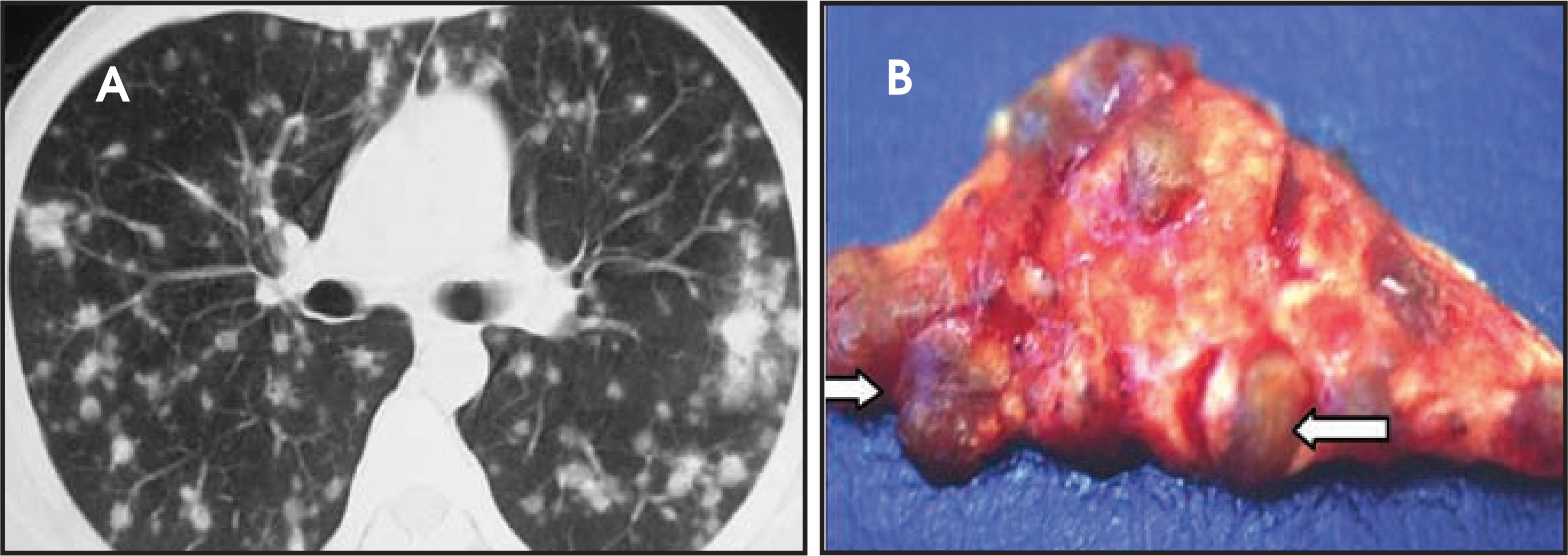 FIGURE 16.