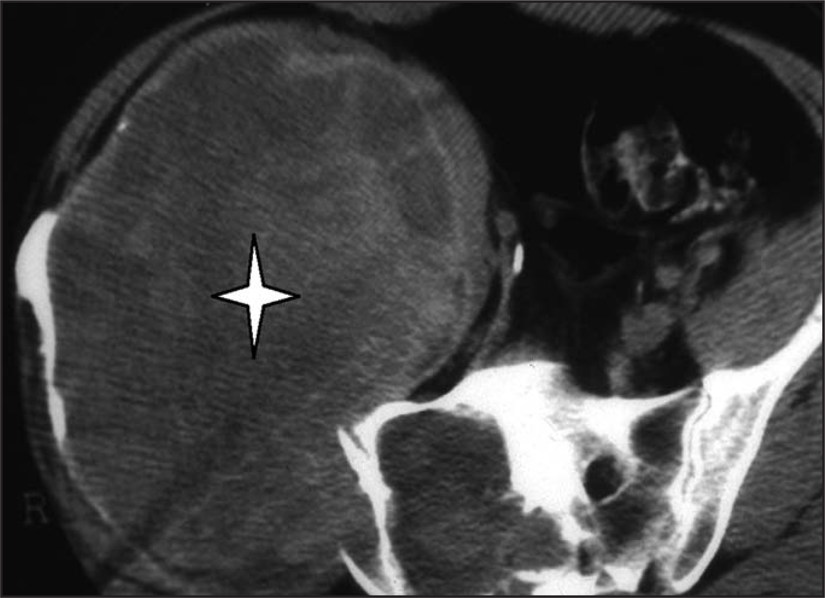 FIGURE 17.