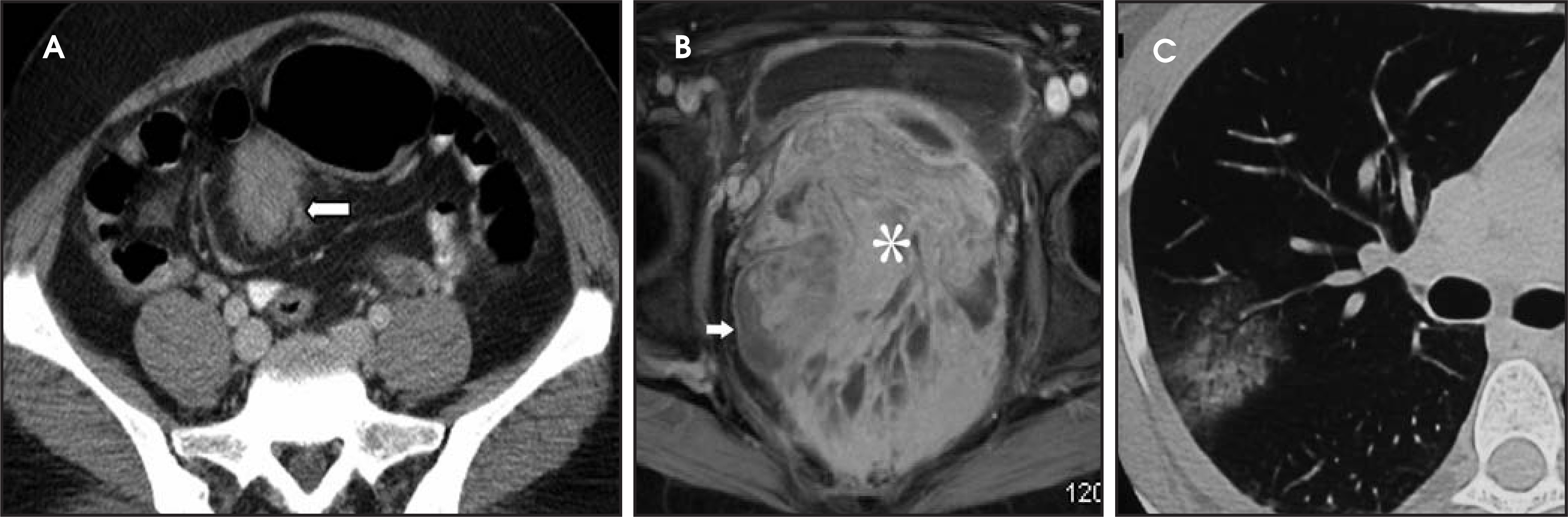 FIGURE 18.