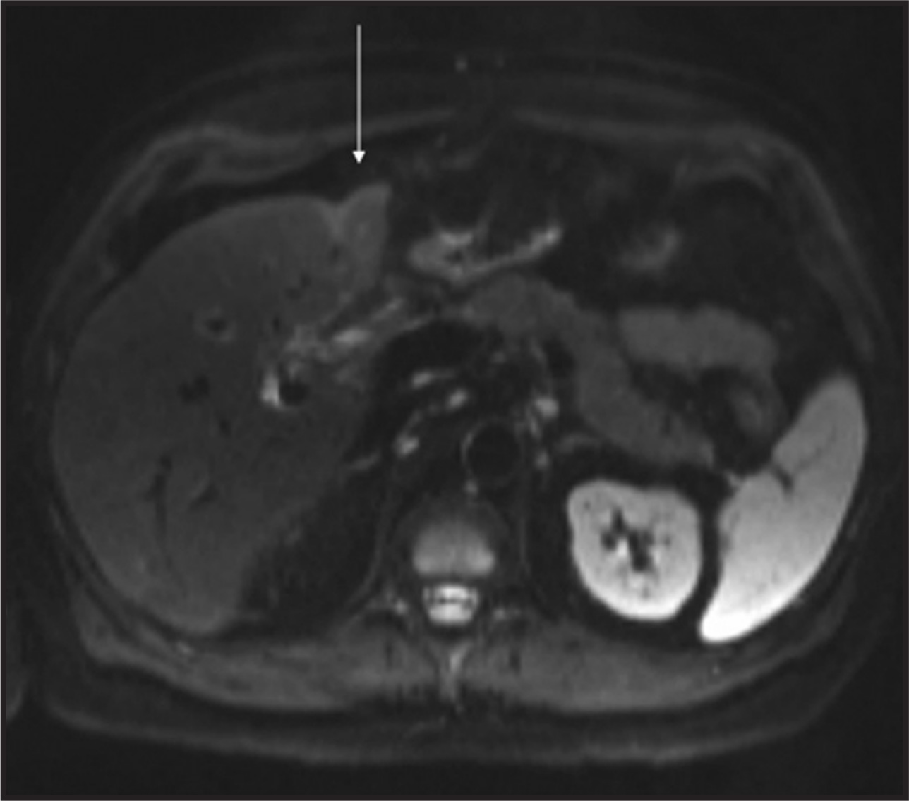 FIGURE 9.