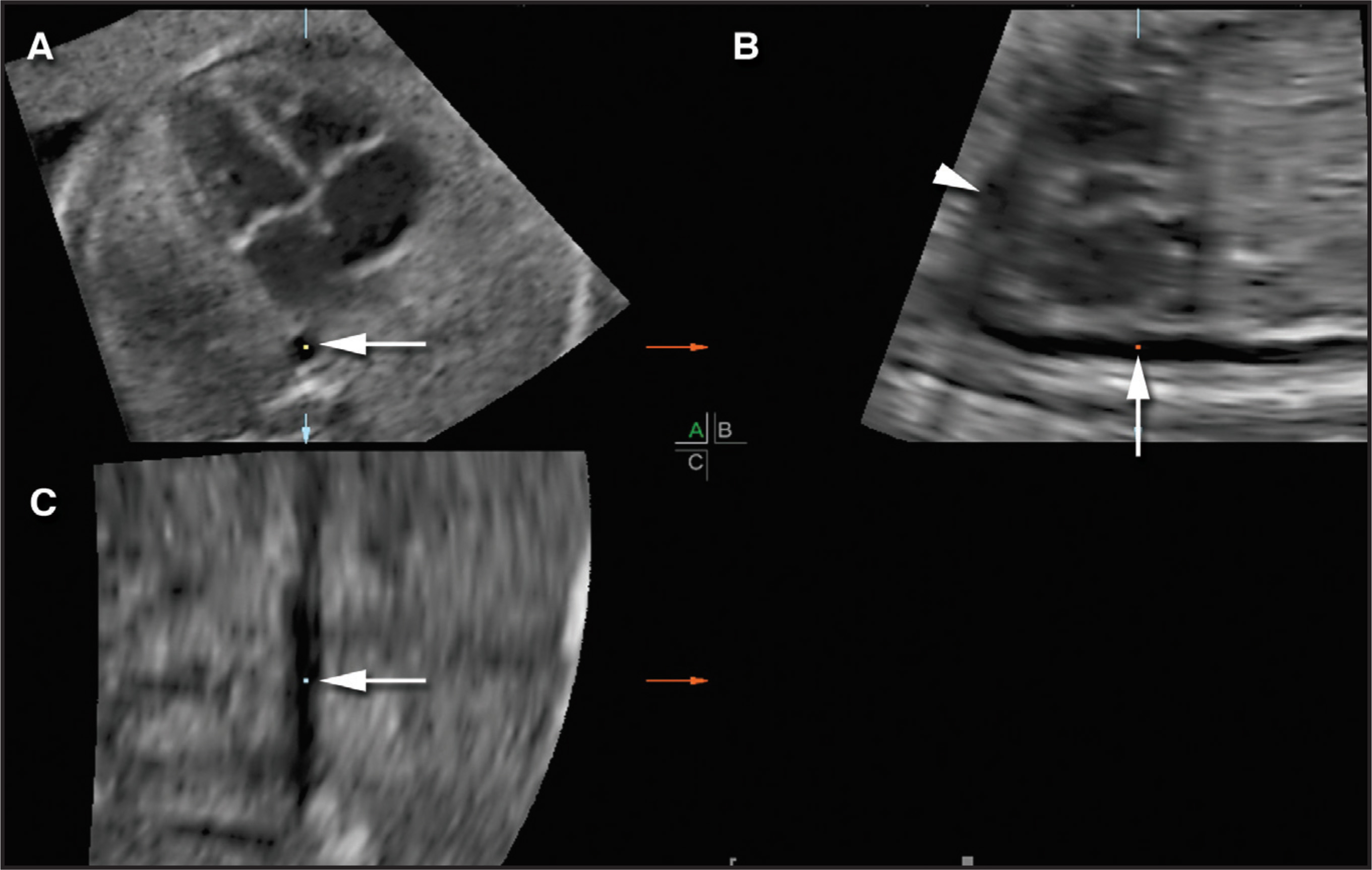 FIGURE 14.