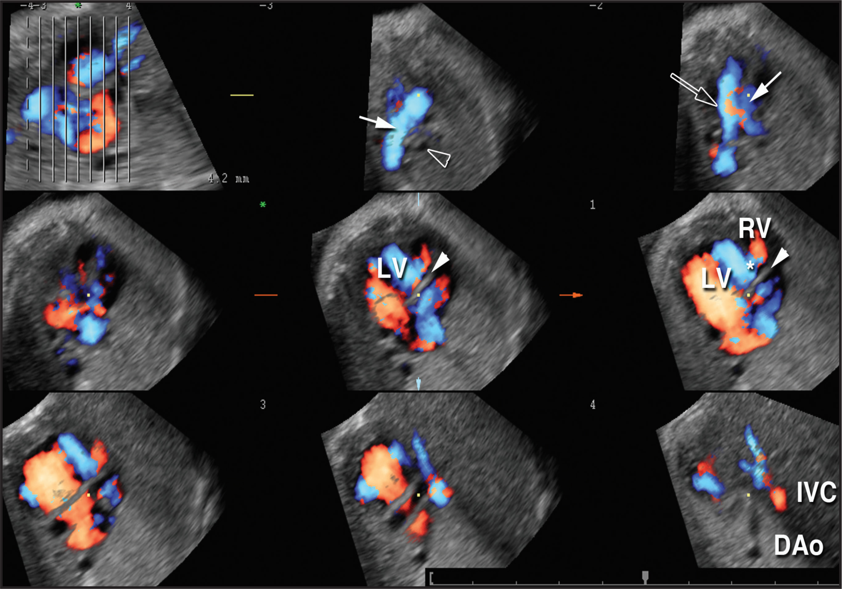 FIGURE 15.