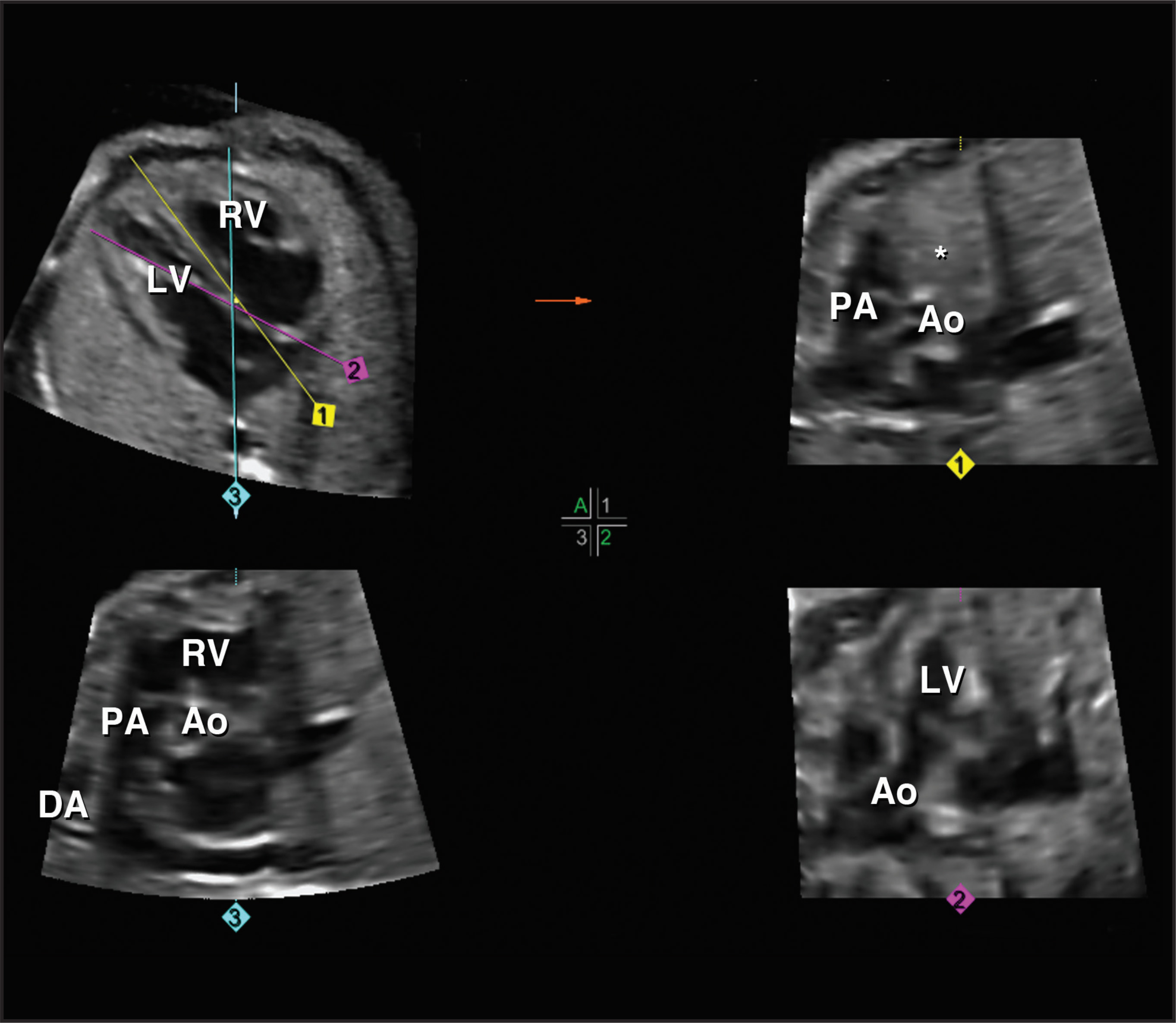 FIGURE 17.