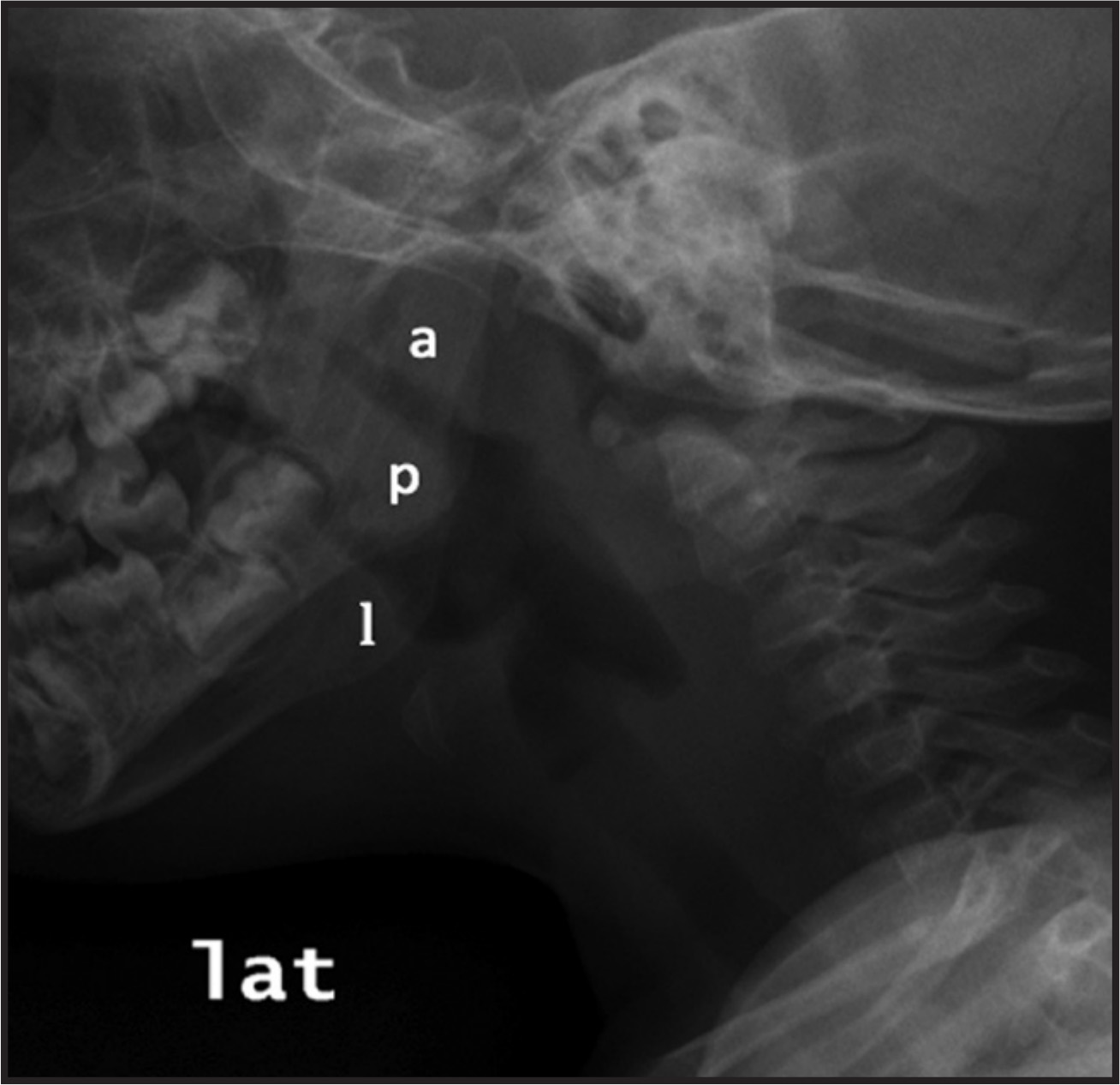 FIGURE 2.