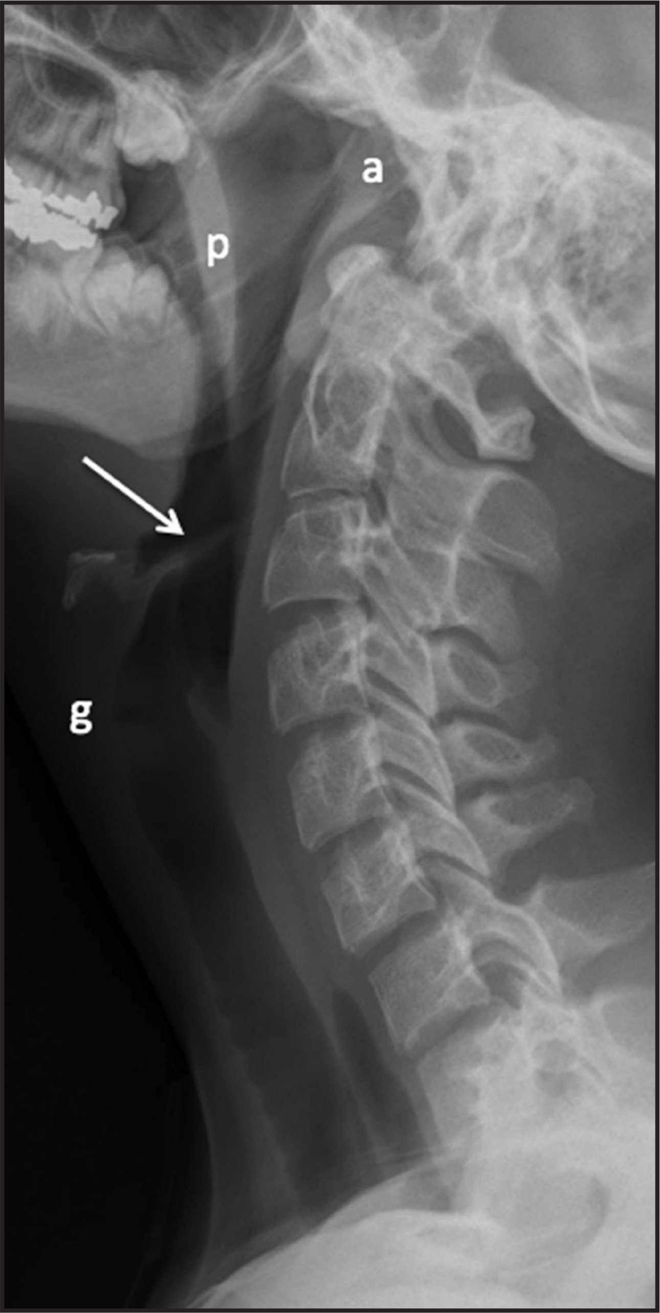 FIGURE 3.