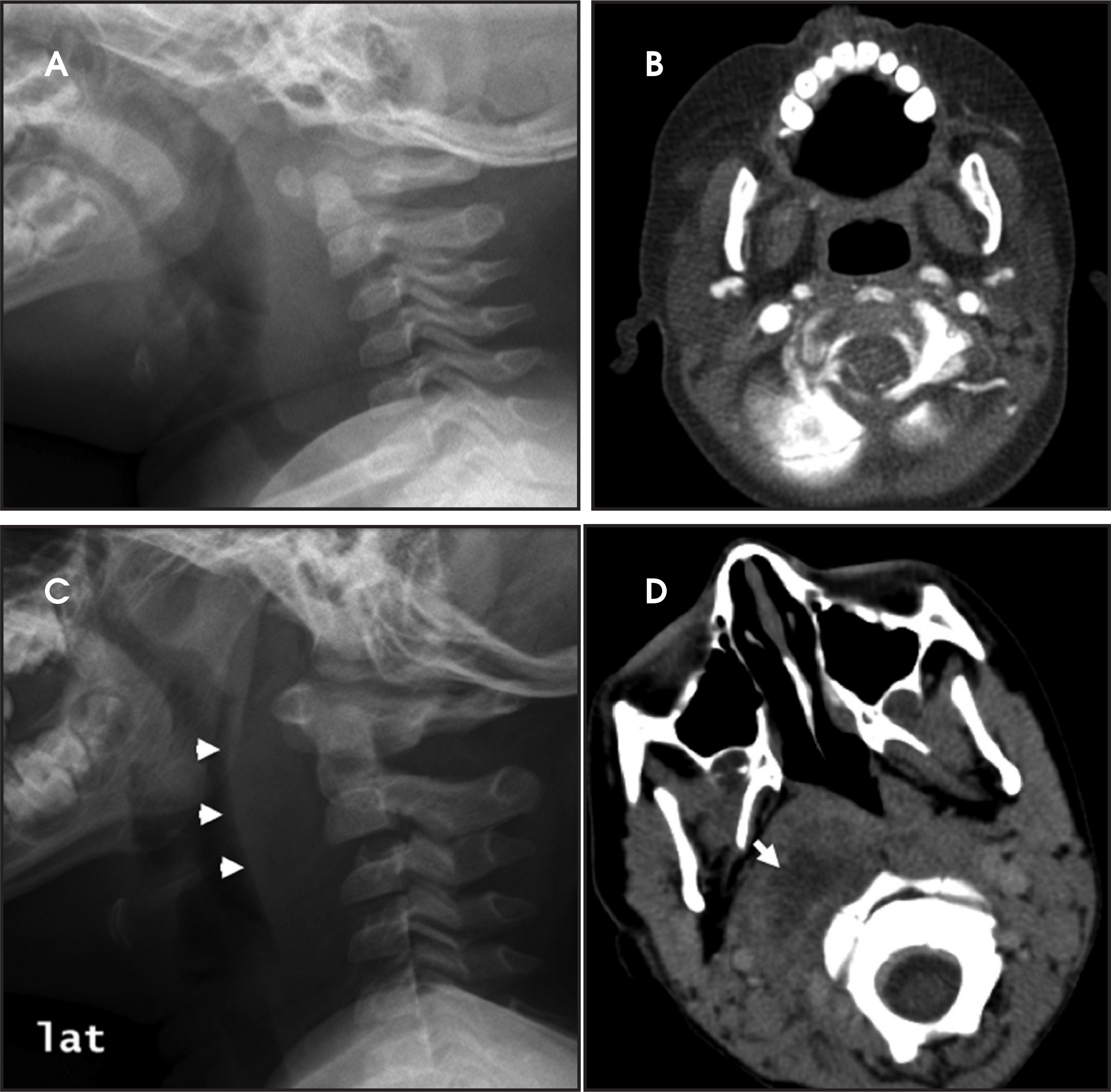 FIGURE 11.