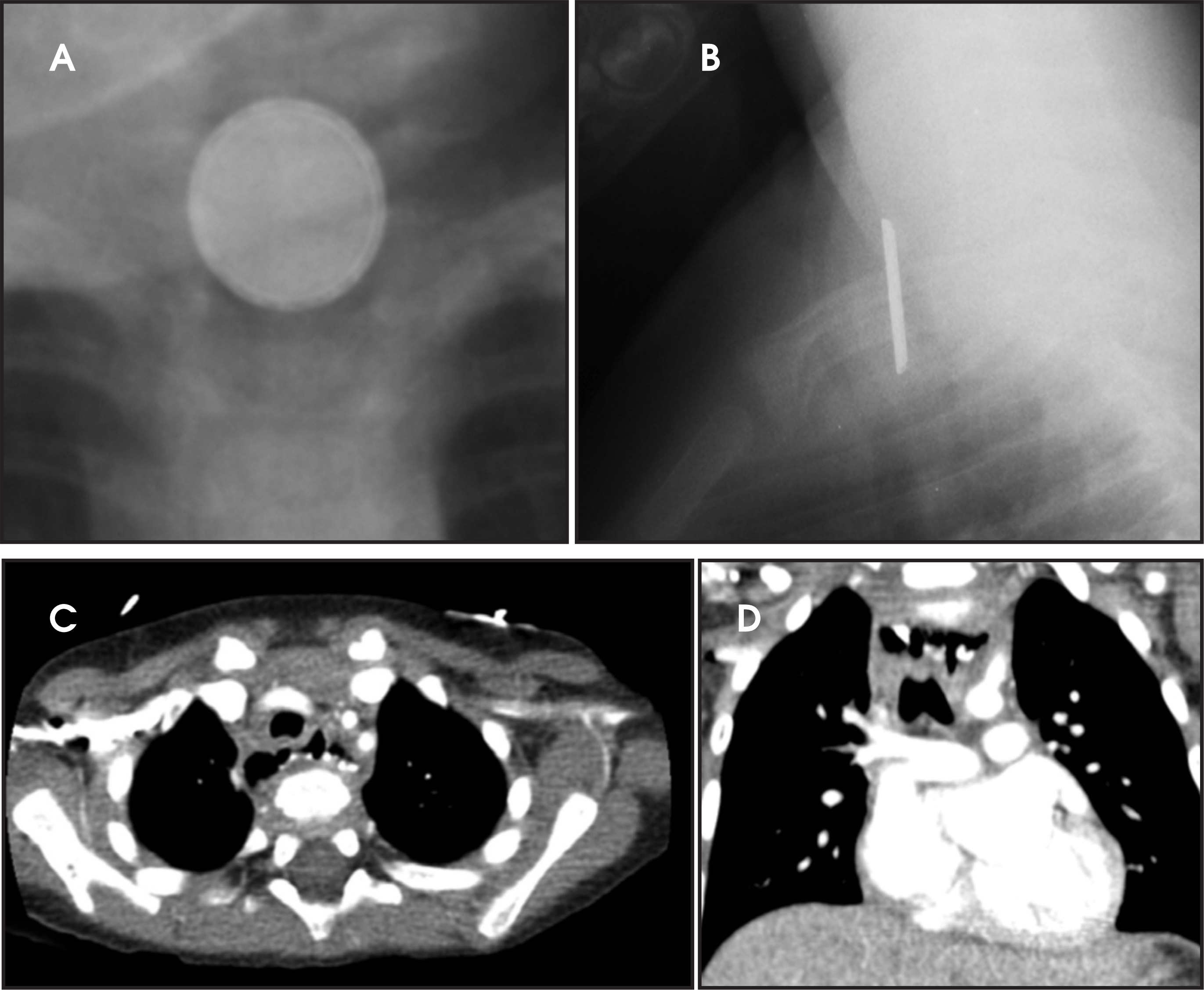 FIGURE 13.