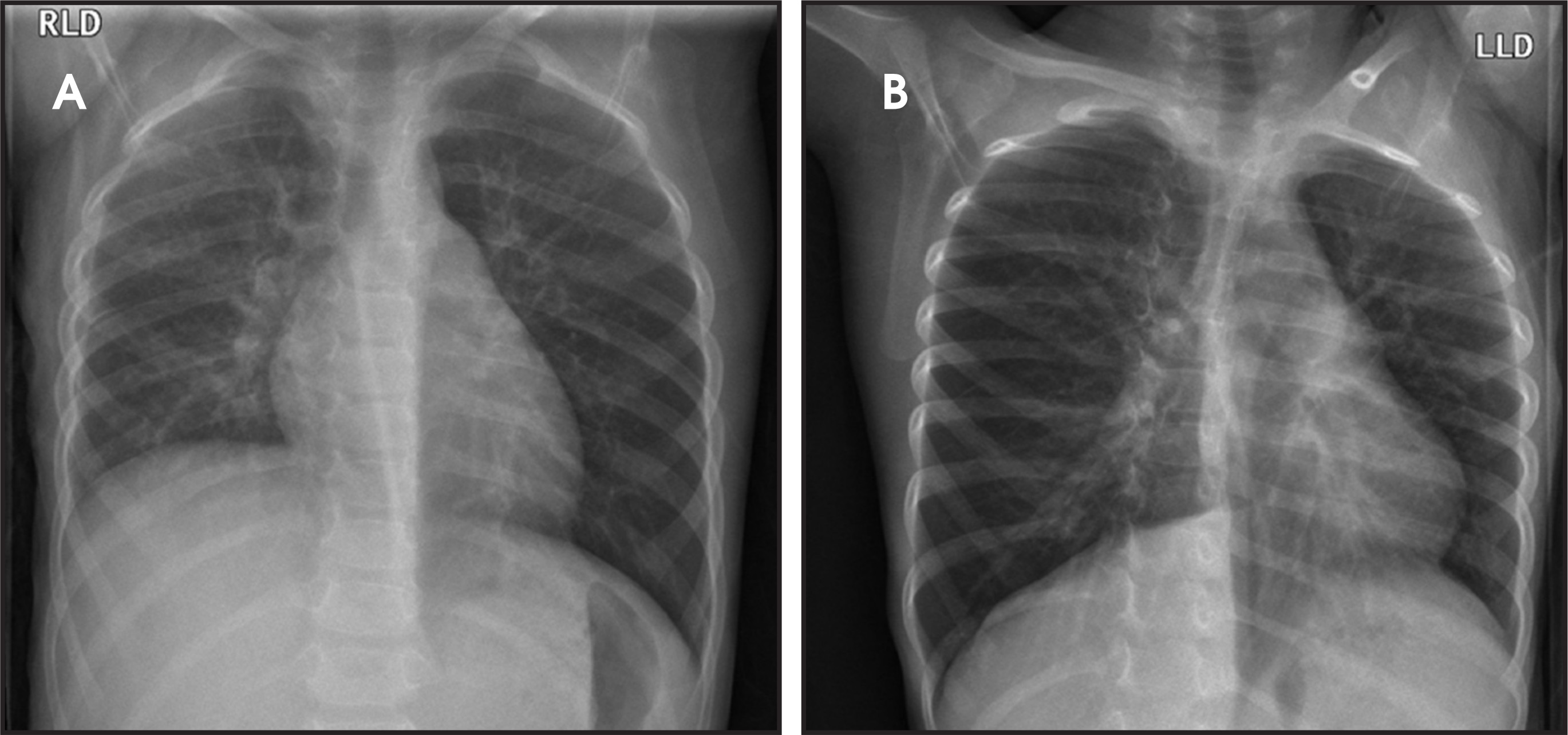 FIGURE 14.