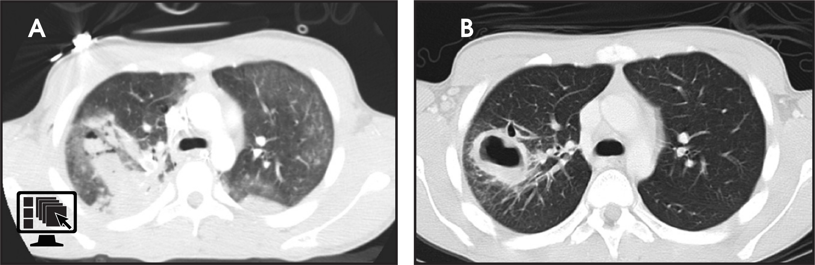 FIGURE 16.