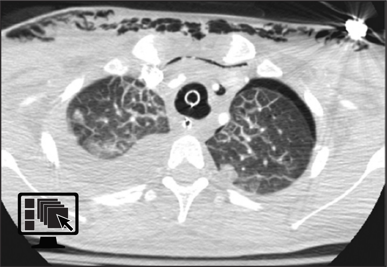 FIGURE 17.