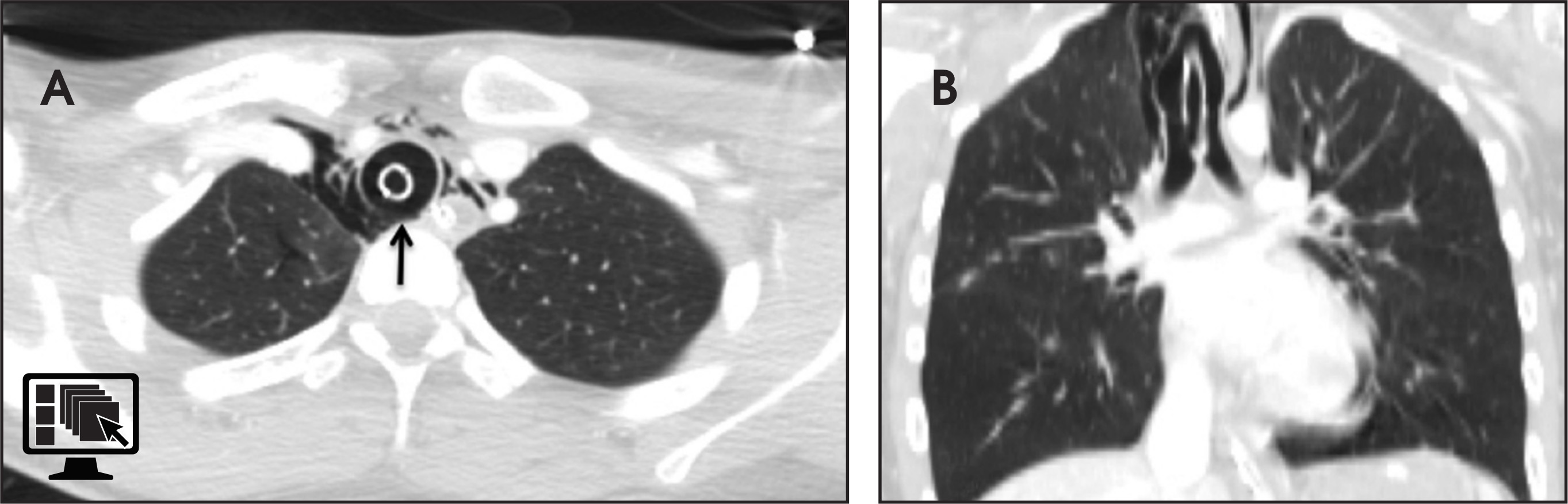 FIGURE 18.