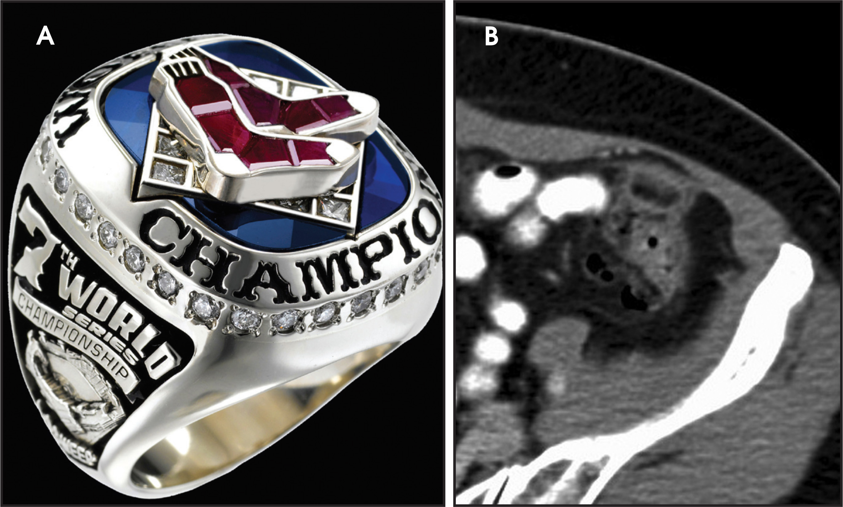 FIGURE 26.